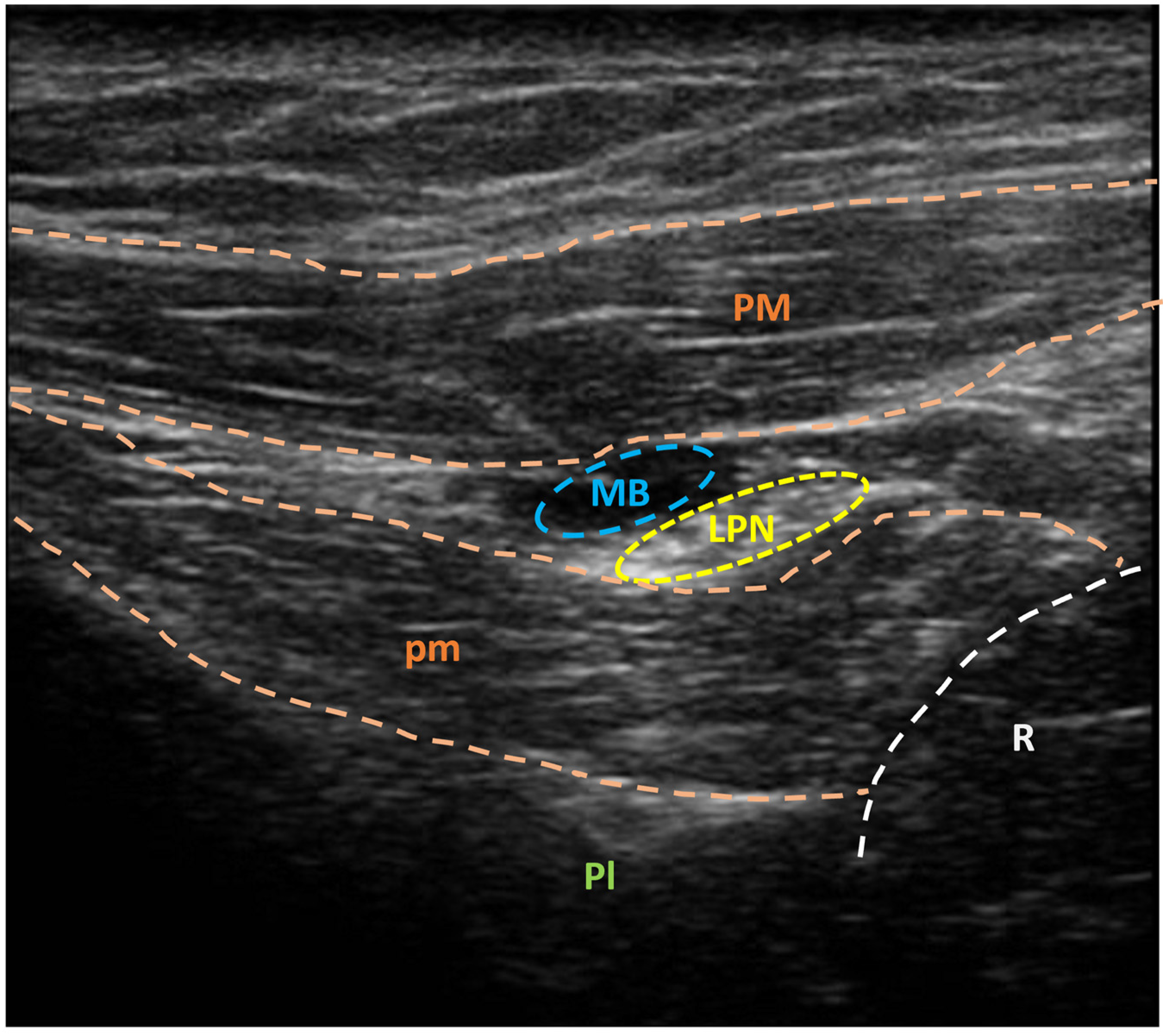 Jpm 14 00116 g003 Jpm 14 00116 g003