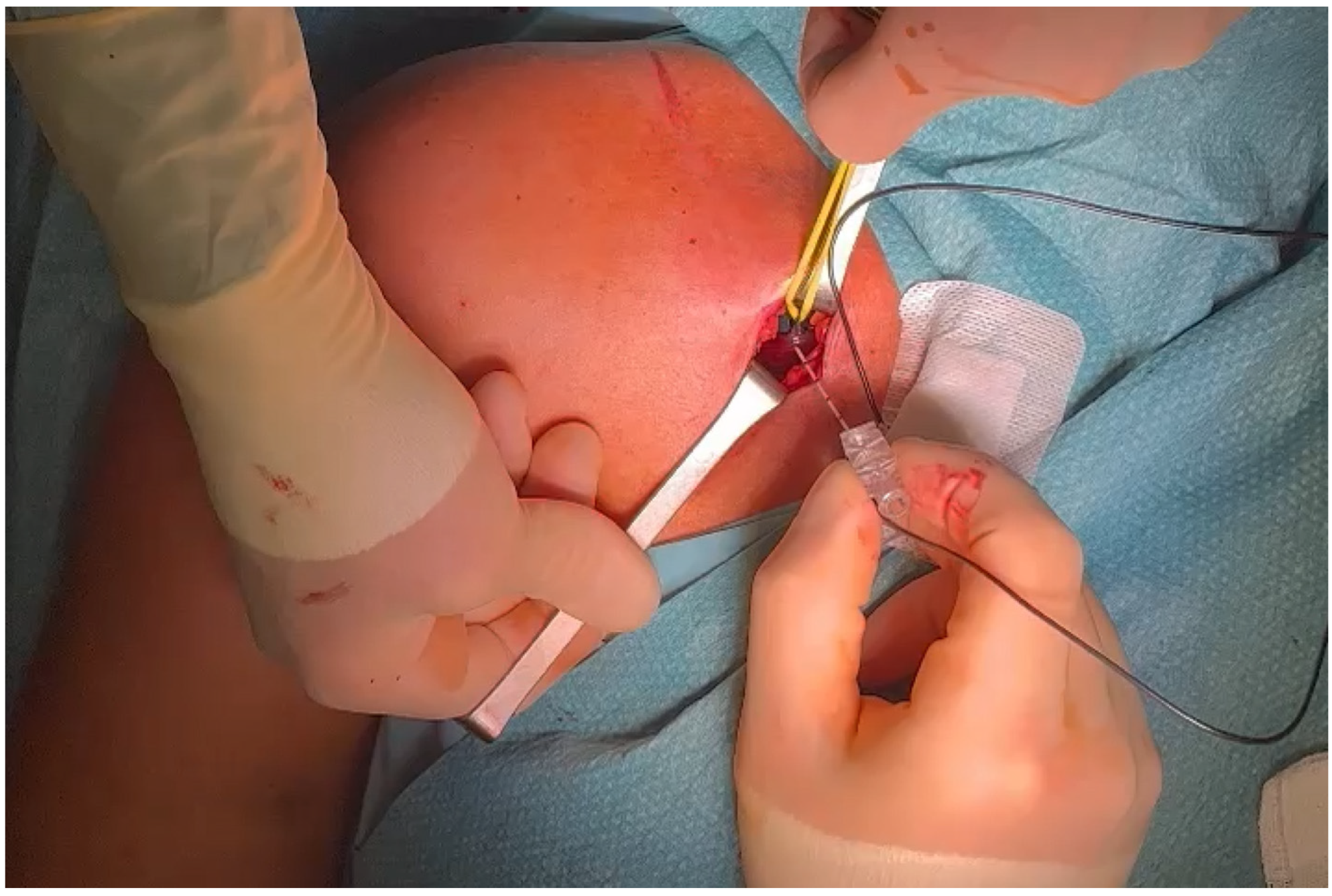 Jpm 14 00116 g005 Jpm 14 00116 g005