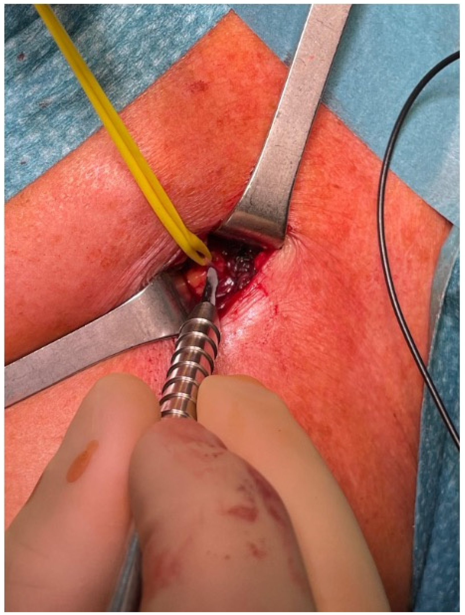 Jpm 14 00116 g006 Jpm 14 00116 g006