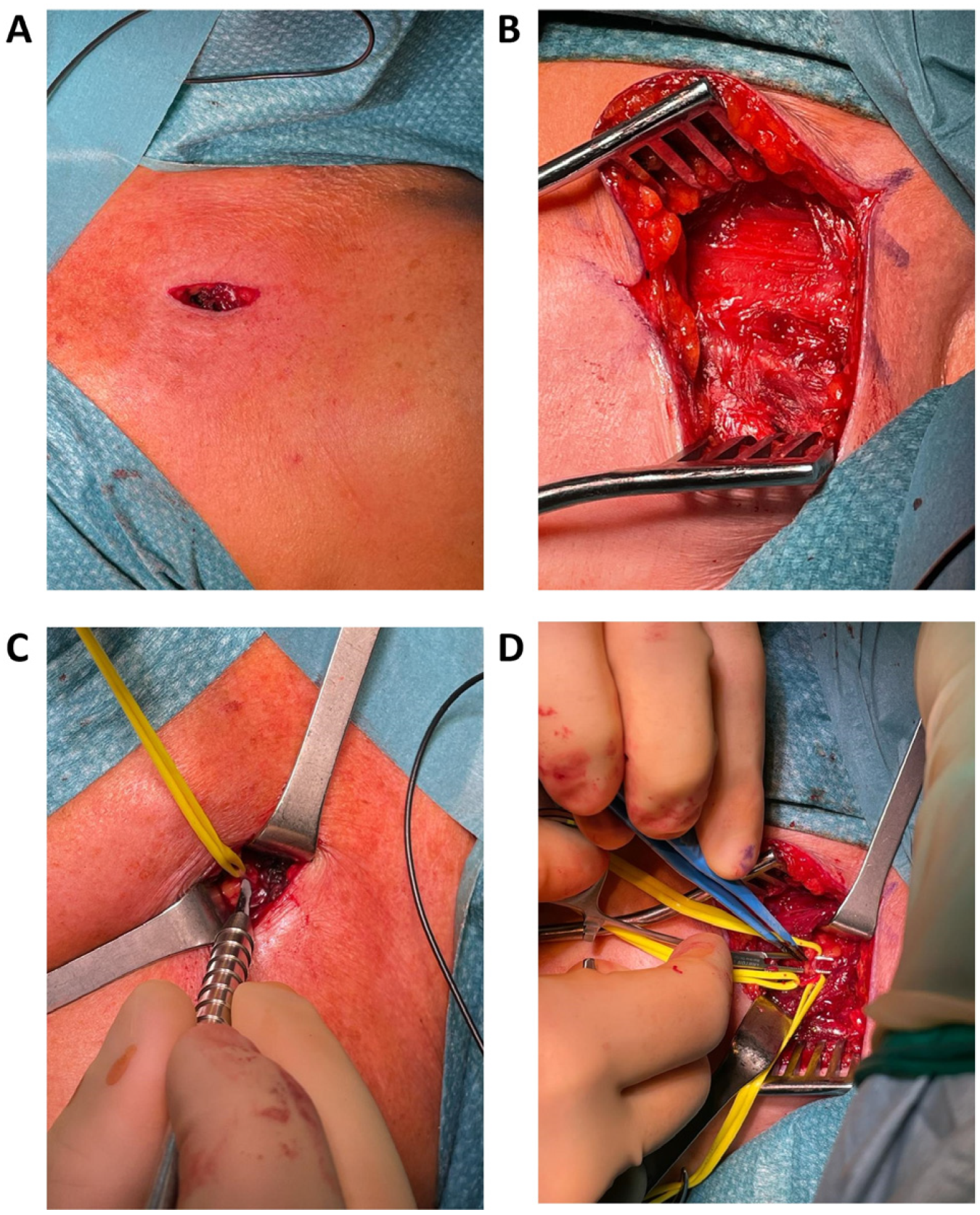 Jpm 14 00116 g007 Jpm 14 00116 g007