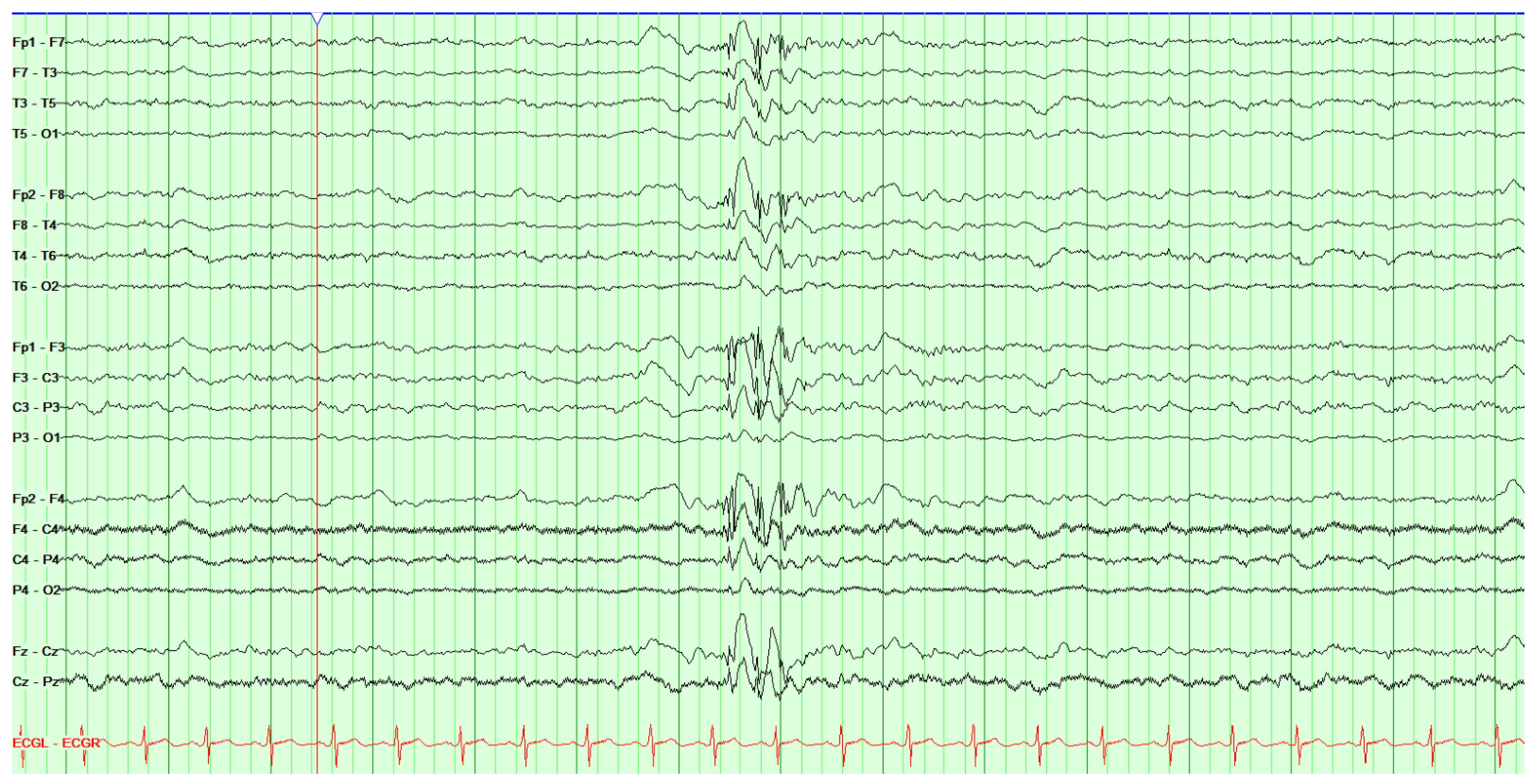 Jpm 14 00118 g002 Jpm 14 00118 g002