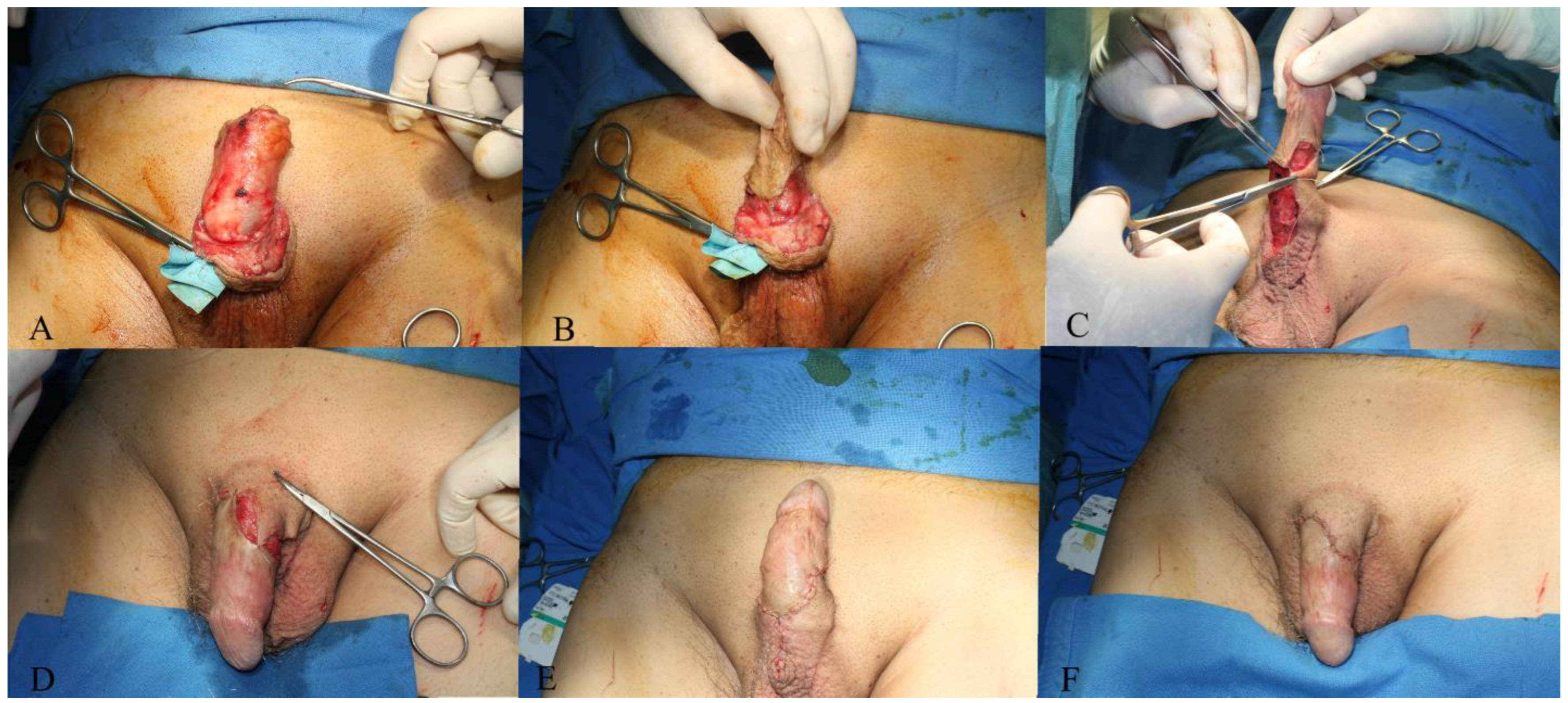 Jpm 14 00887 g004 Jpm 14 00887 g004