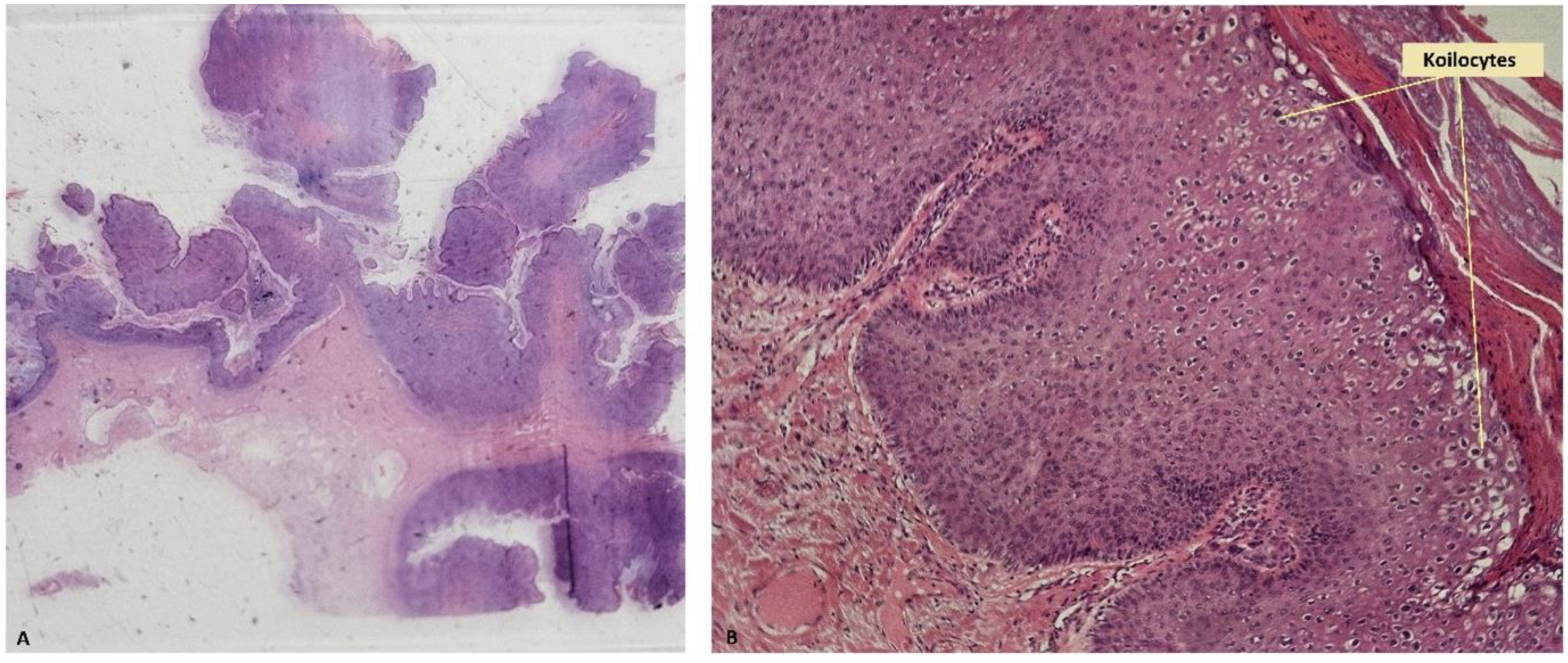 Jpm 14 00887 g005 Jpm 14 00887 g005