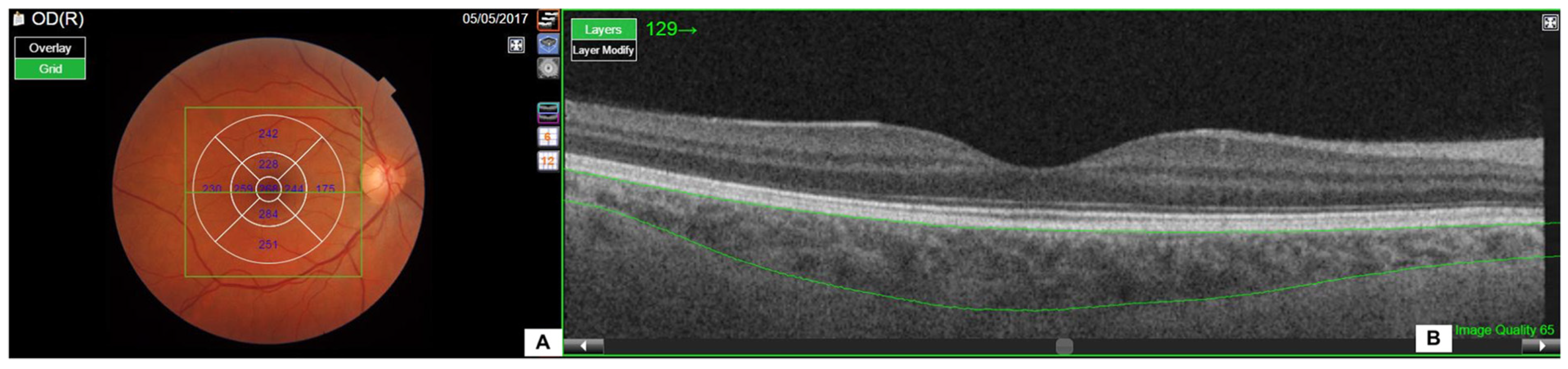 Jpm 14 01123 g001 Jpm 14 01123 g001