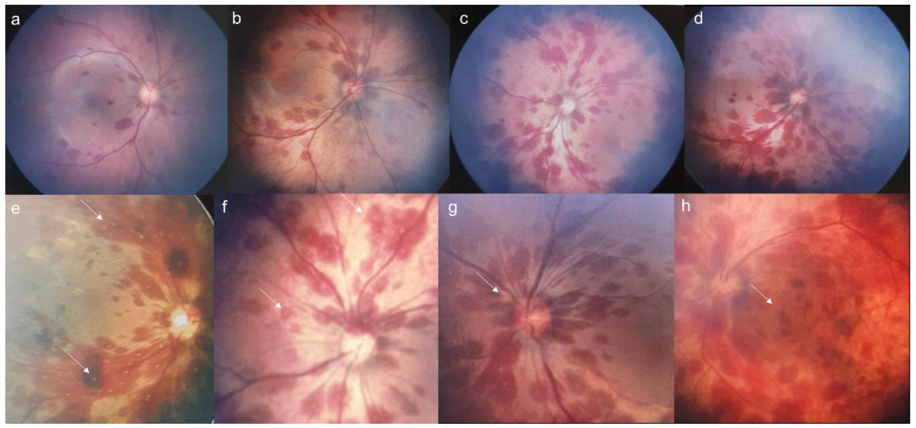 Jpm 15 00038 g002 Jpm 15 00038 g002