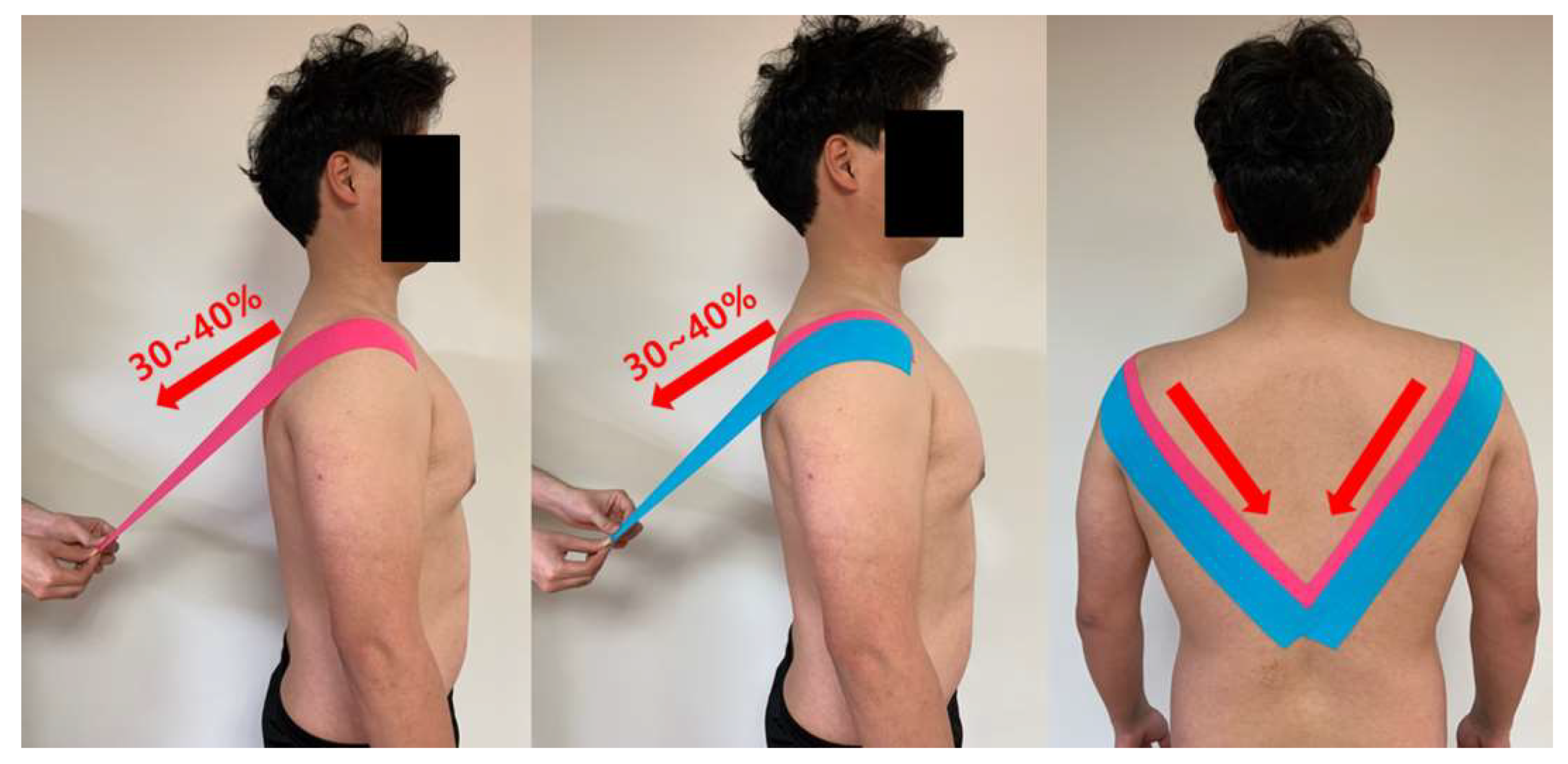 Life | Free Full-Text | Effects of Kinesiology Taping on Shoulder Posture  and Peak Torque in Junior Baseball Players with Rounded Shoulder Posture: A  Pilot Study