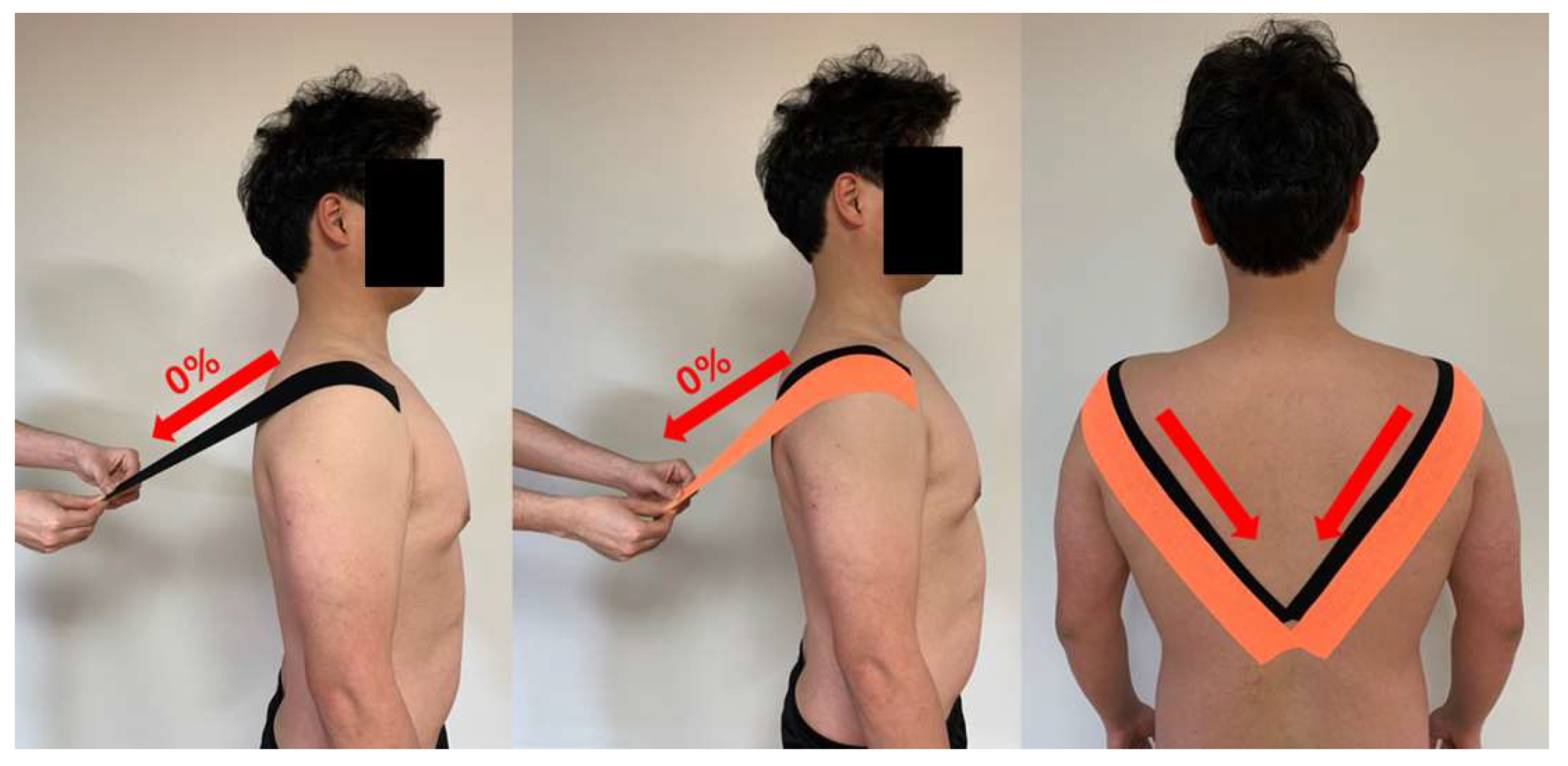 Is Rounded Shoulders And Forwarded Head Causing Pain?