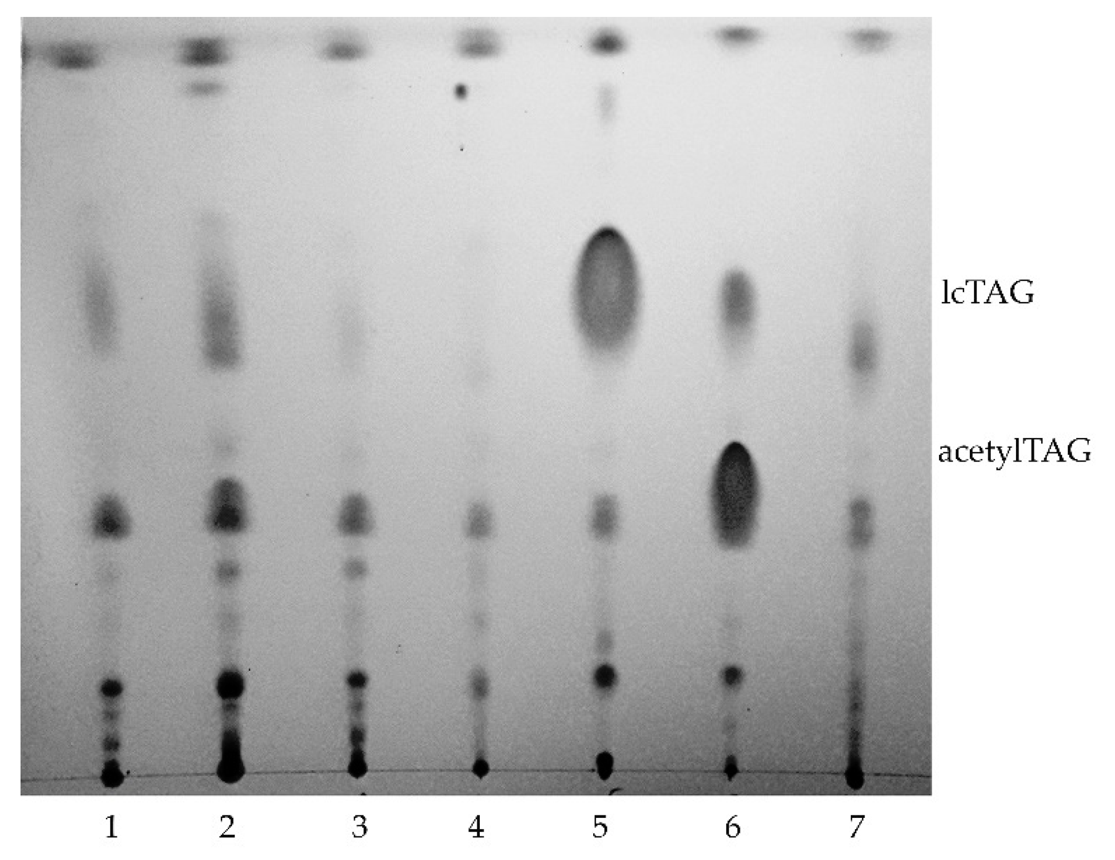 Life | Free Full-Text | Diacylglycerol Acetyltransferase Gene Isolated from  Euonymus europaeus L. Altered Lipid Metabolism in Transgenic Plant towards  the Production of Acetylated Triacylglycerols | HTML