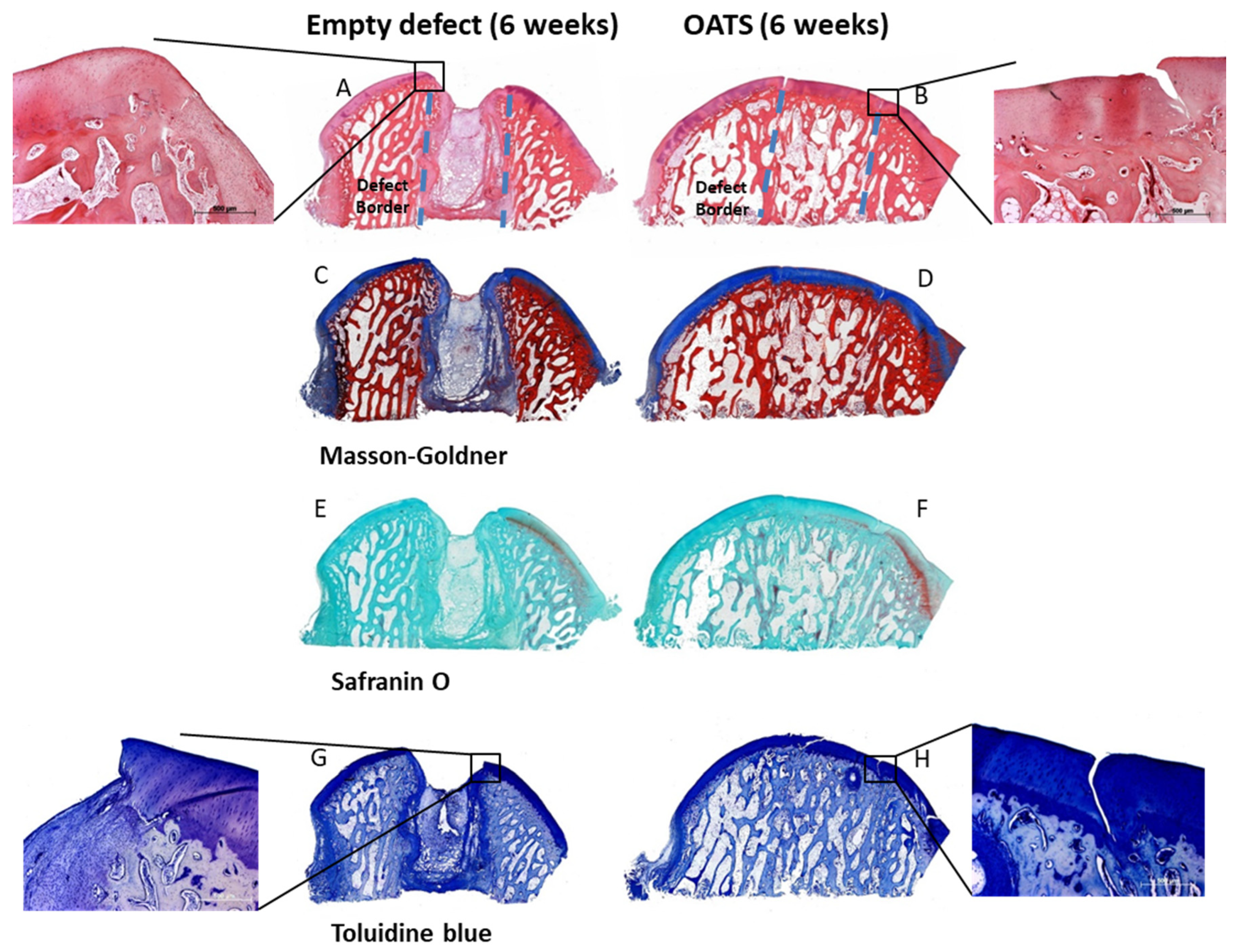 Life Free Full Text Systematic Postoperative Assessment Of A Minimally Invasive Sheep Model For The Treatment Of Osteochondral Defects Html