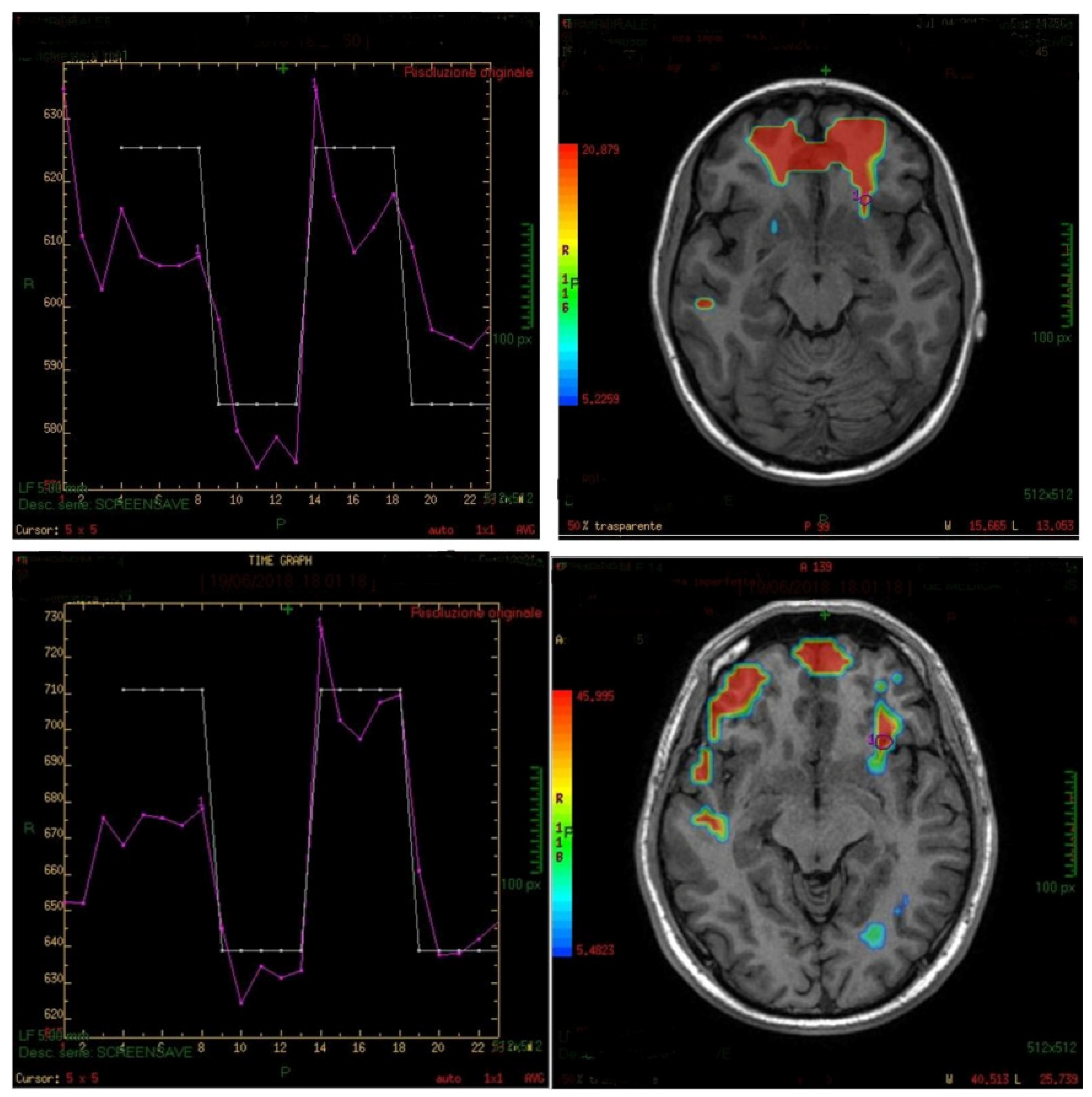 Life | Free Full-Text | Functional Magnetic Resonance Imaging In The ...