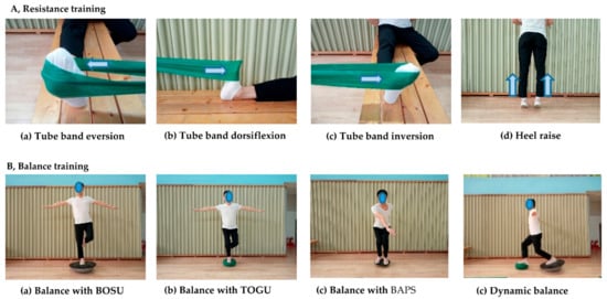Resistance and Balance Exercises Improve Gait in Post-Surgical Ankle  Fractures - Performance Health Academy