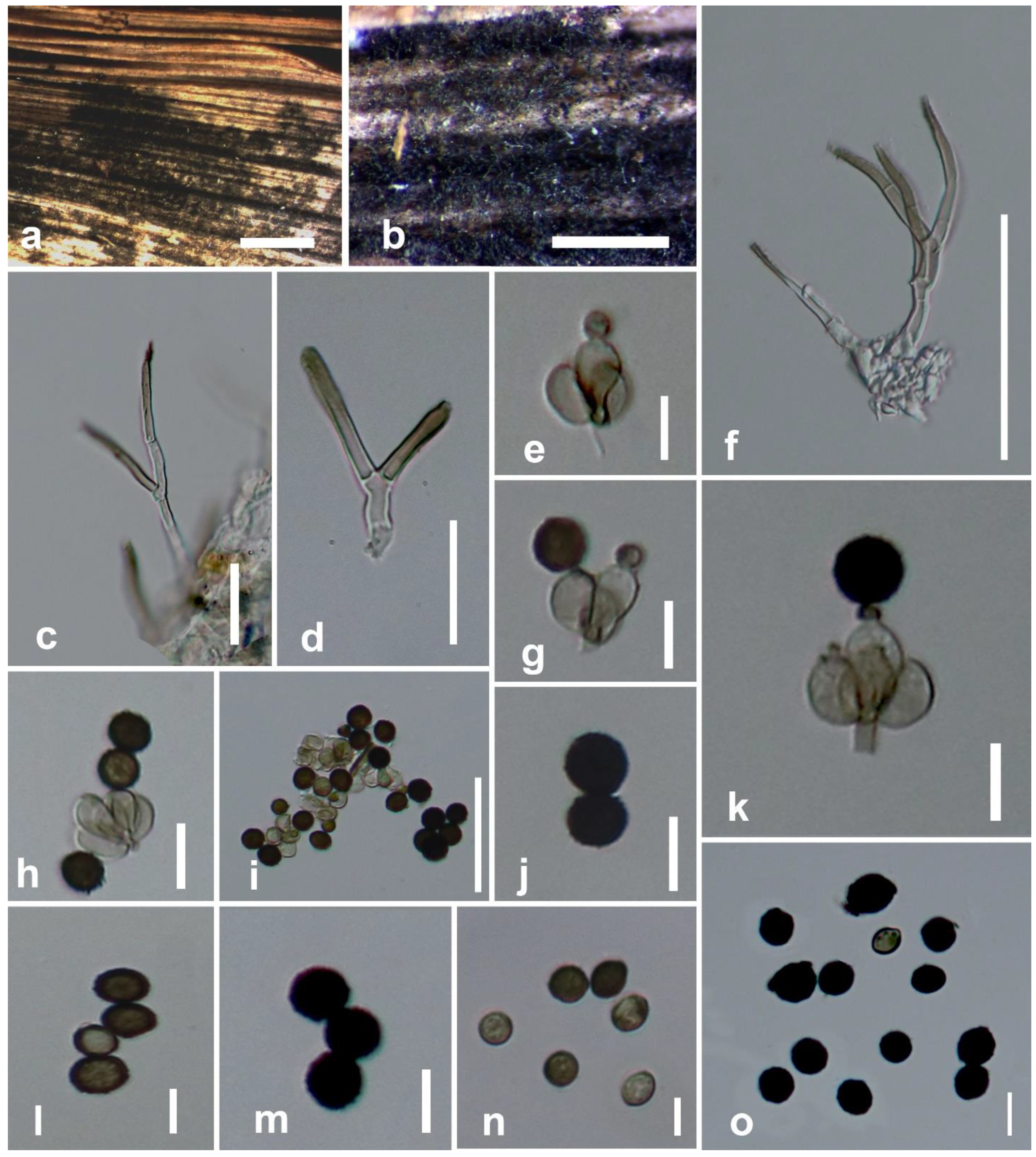 Life Free Full Text Stachybotrys Musae Sp Nov S Microsporus And Memnoniella Levispora Stachybotryaceae Hypocreales Found On Bananas In China And Thailand Html