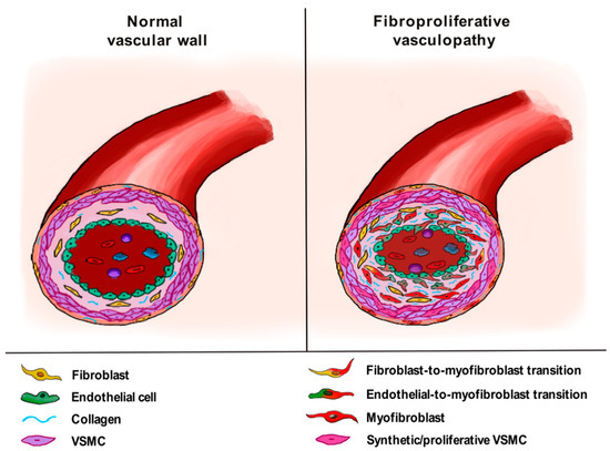 Life | Free Full-Text | New Insights into Profibrotic Myofibroblast  Formation in Systemic Sclerosis: When the Vascular Wall Becomes the Enemy |  HTML