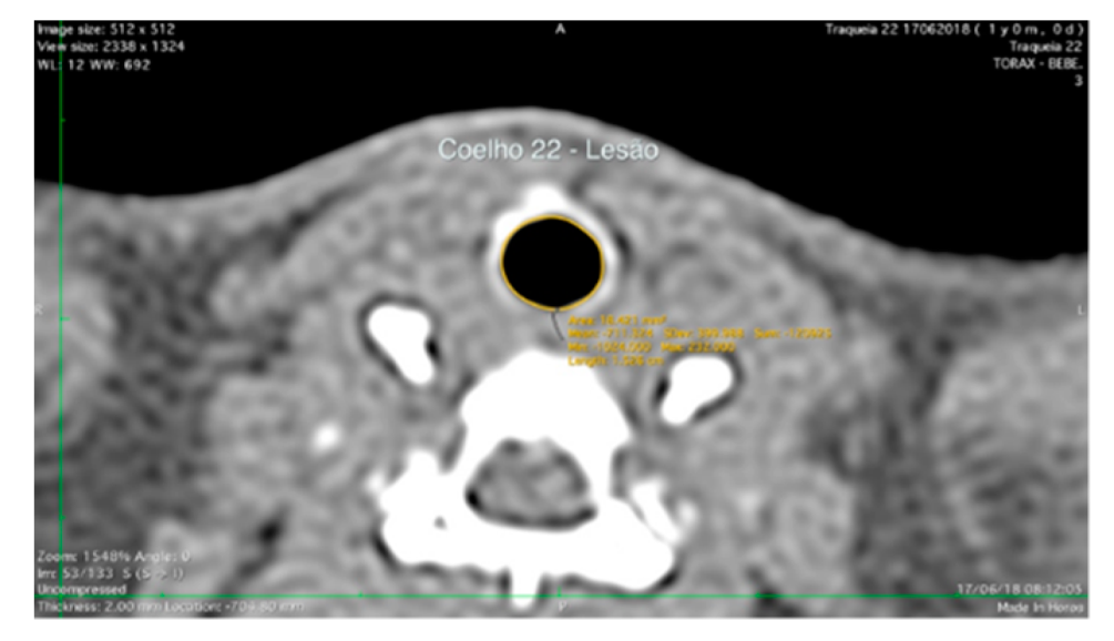 Life Free Full Text Tracheal Repair With Human Umbilical Cord Mesenchymal Stem Cells Differentiated In Chondrocytes Grown On An Acellular Amniotic Membrane A Pre Clinical Approach Html