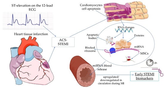 Peripheral Blood RNAs and Left Ventricular Dysfunction after Myocardial  Infarction: Towards Translation into Clinical Practice