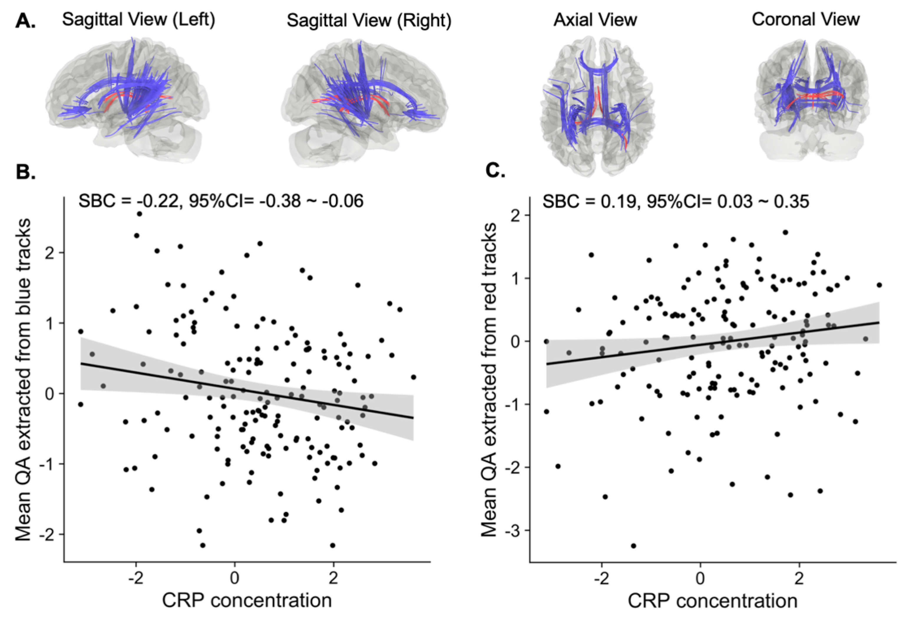 Life | Free Full-Text | Elevated Systemic Inflammation Is Associated with  Reduced Corticolimbic White Matter Integrity in Depression | HTML