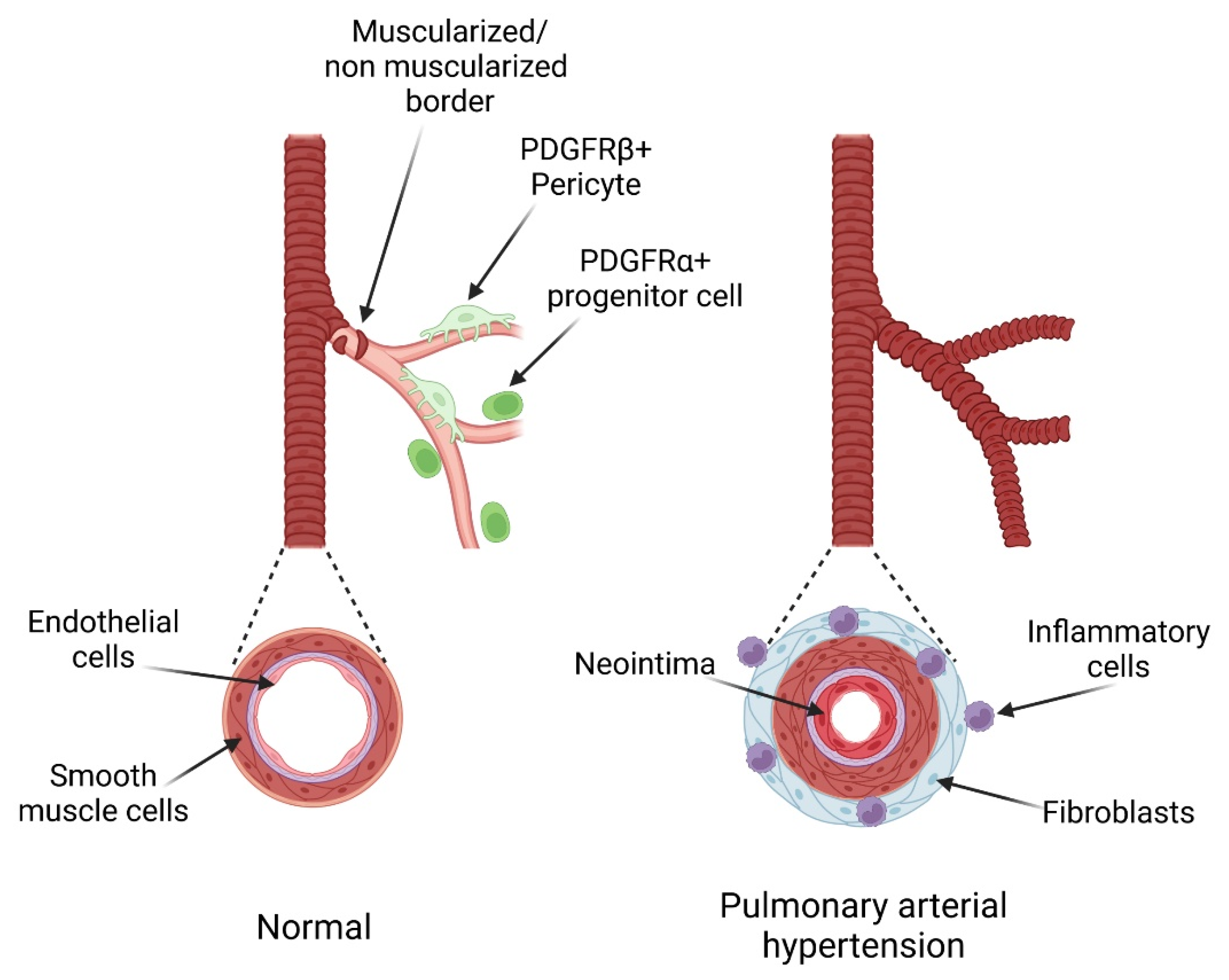 Attenuation of hypertension by C-fiber stimulation of the human