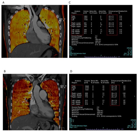 Quantification of Breast Volume According to age and BMI: A Three