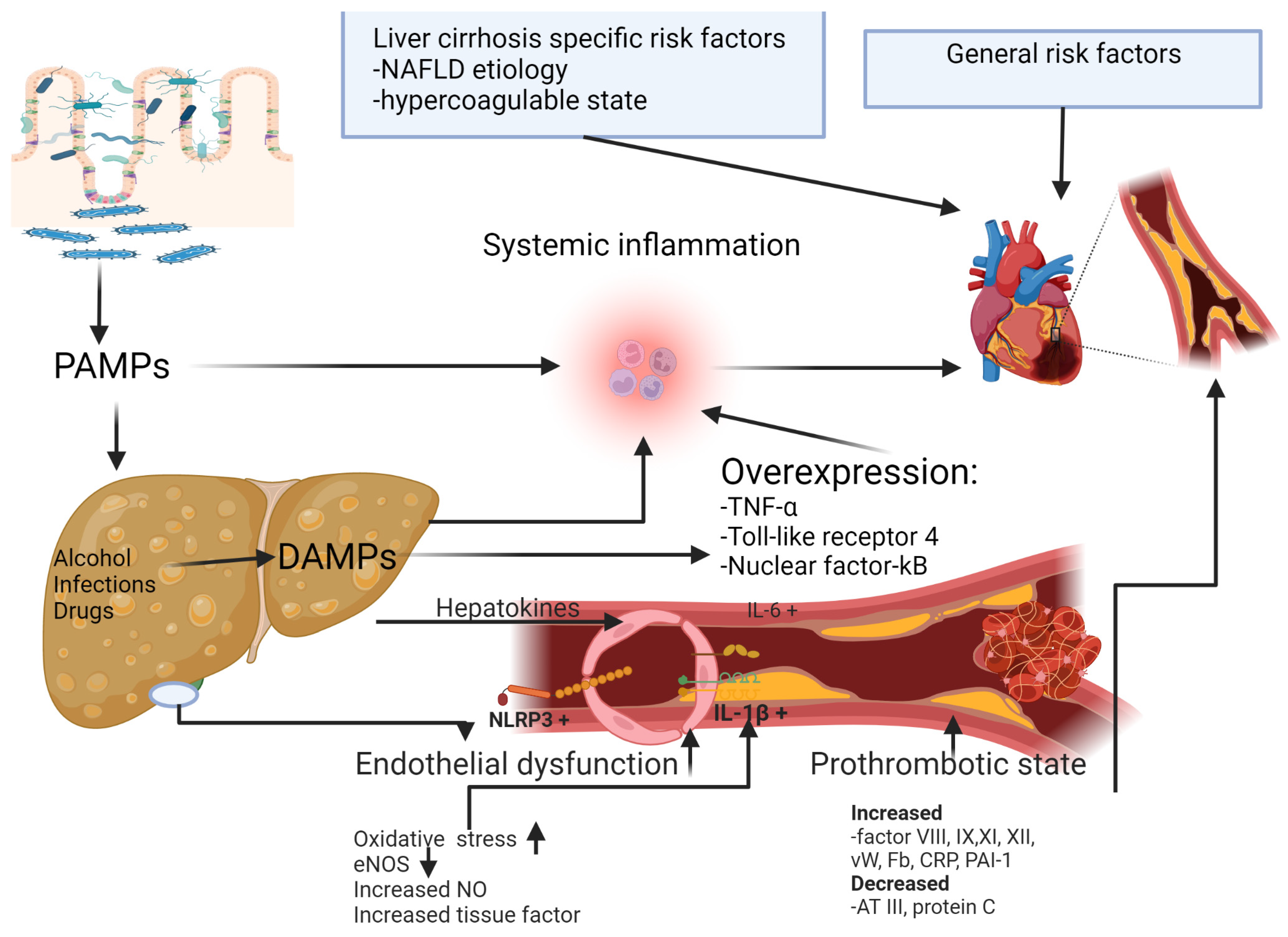 Life | Free Full-Text | Ischemic Heart Disease and Liver Cirrhosis: Adding  Insult to Injury