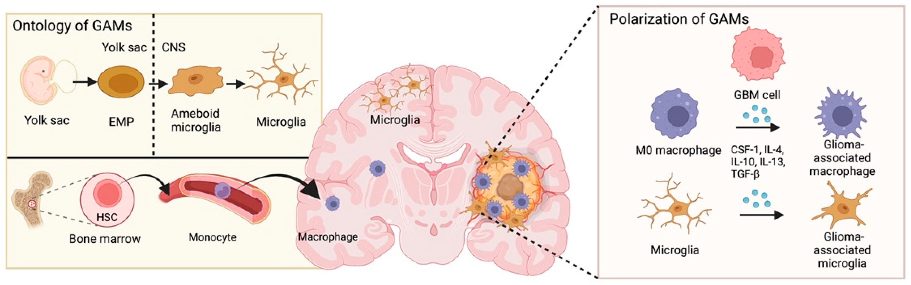 Life | Free Full-Text | Macrophages in Glioblastoma Development and  Therapy: A Double-Edged Sword