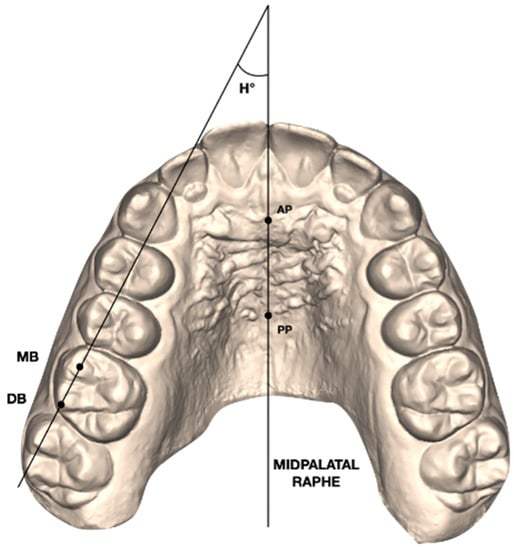 Diagrammatic representation of the normal anatomy of the mandibular