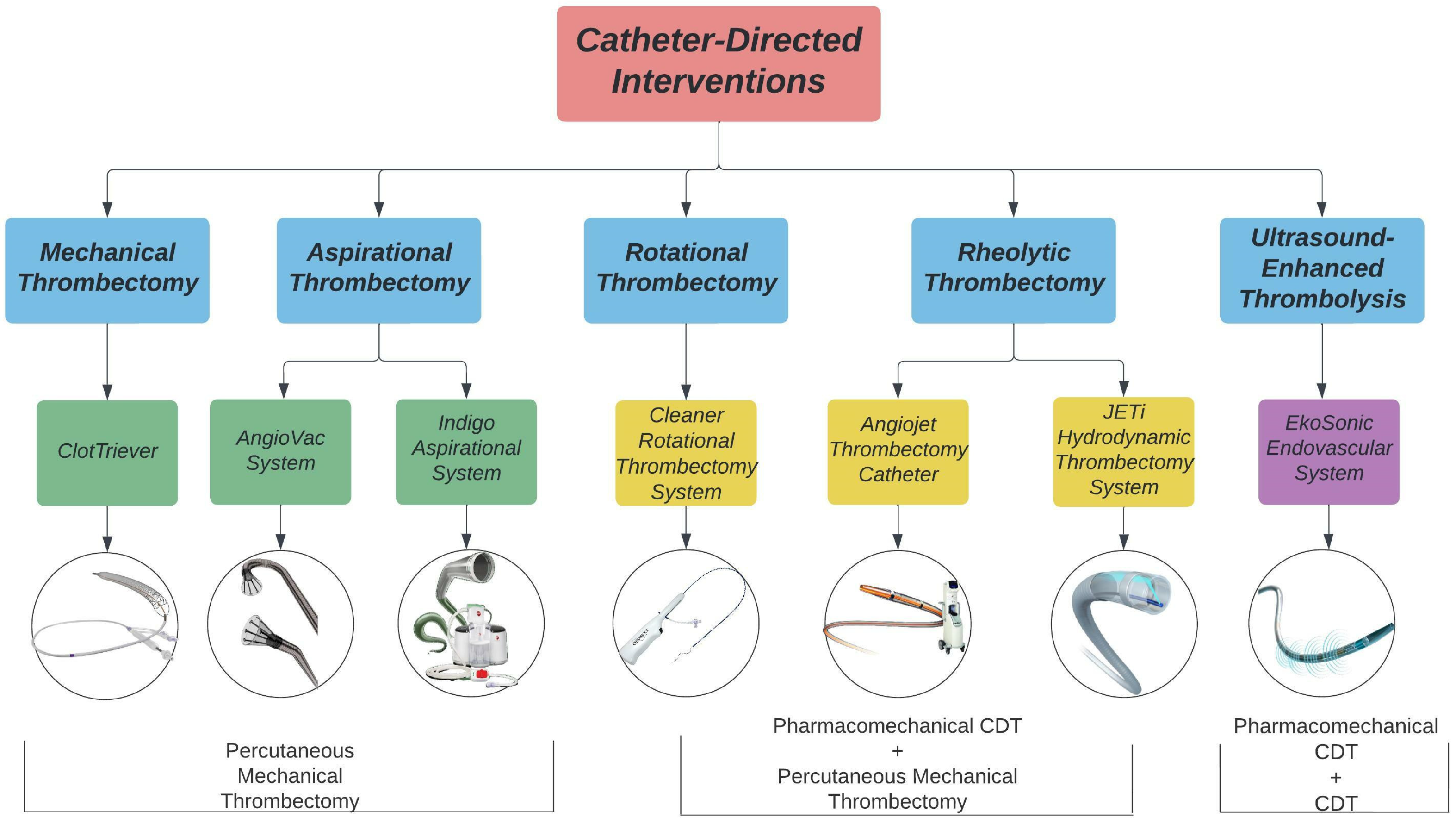 Life | Free Full-Text | Catheter-Directed Interventions for the Treatment  of Lower Extremity Deep Vein Thrombosis