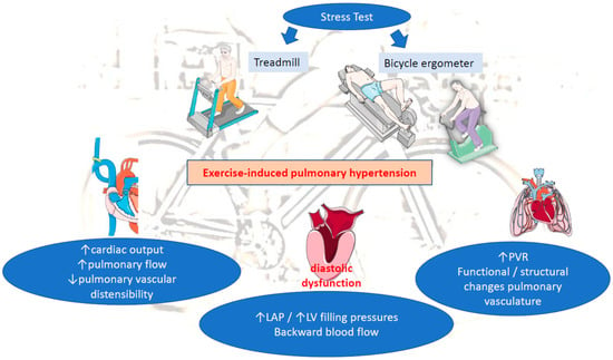 Braz J Cardiovasc Surg - The pulmonary vascular blood supply in