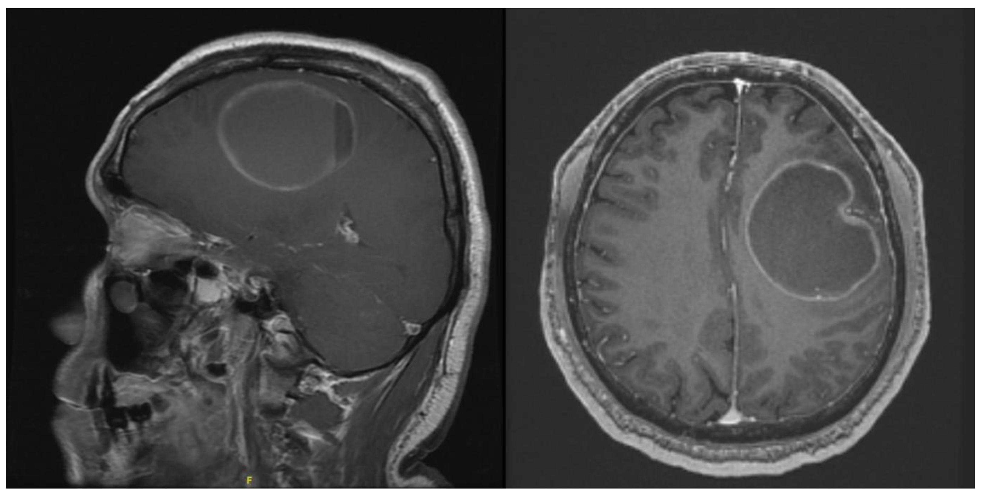 Life Free Full Text Use Of Mixed Reality In Neuro Oncology A   Life 13 00398 G007 