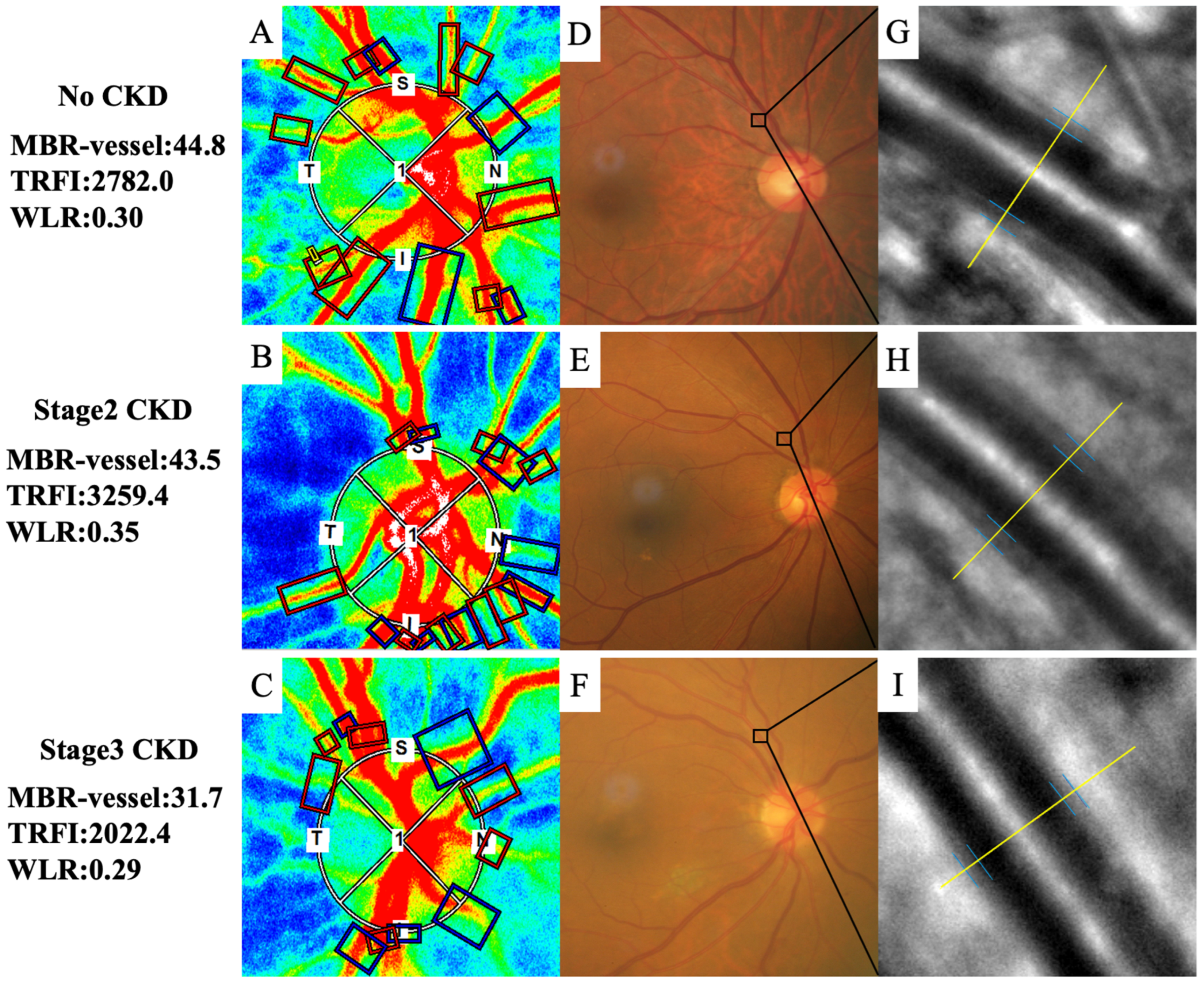 Life | Free Full-Text | Relationship Between Retinal Microcirculation and  Renal Function in Patients with Diabetes and Chronic Kidney Disease by Laser  Speckle Flowgraphy