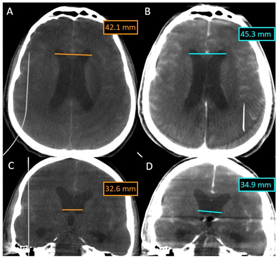 5 Use Cases Of AI-powered Medical Imaging In Healthcare - Onix