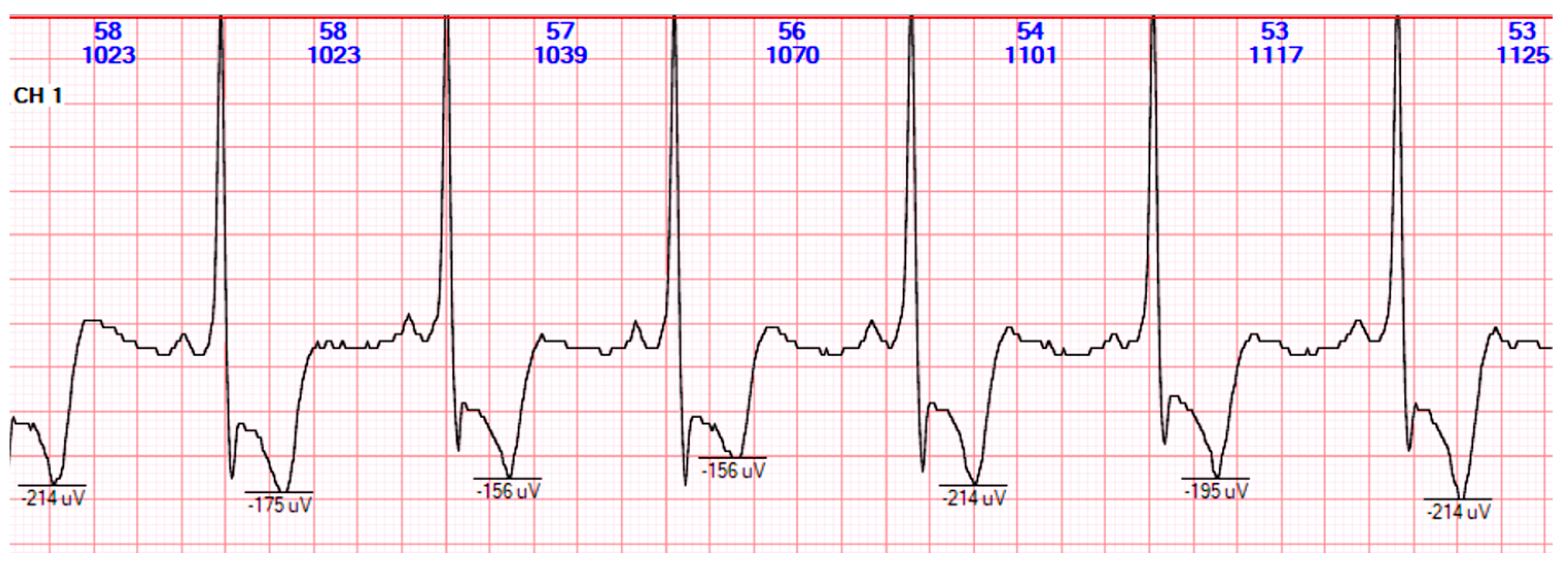 24h ECG Holter Monitor £170, London Cardiology Clinics