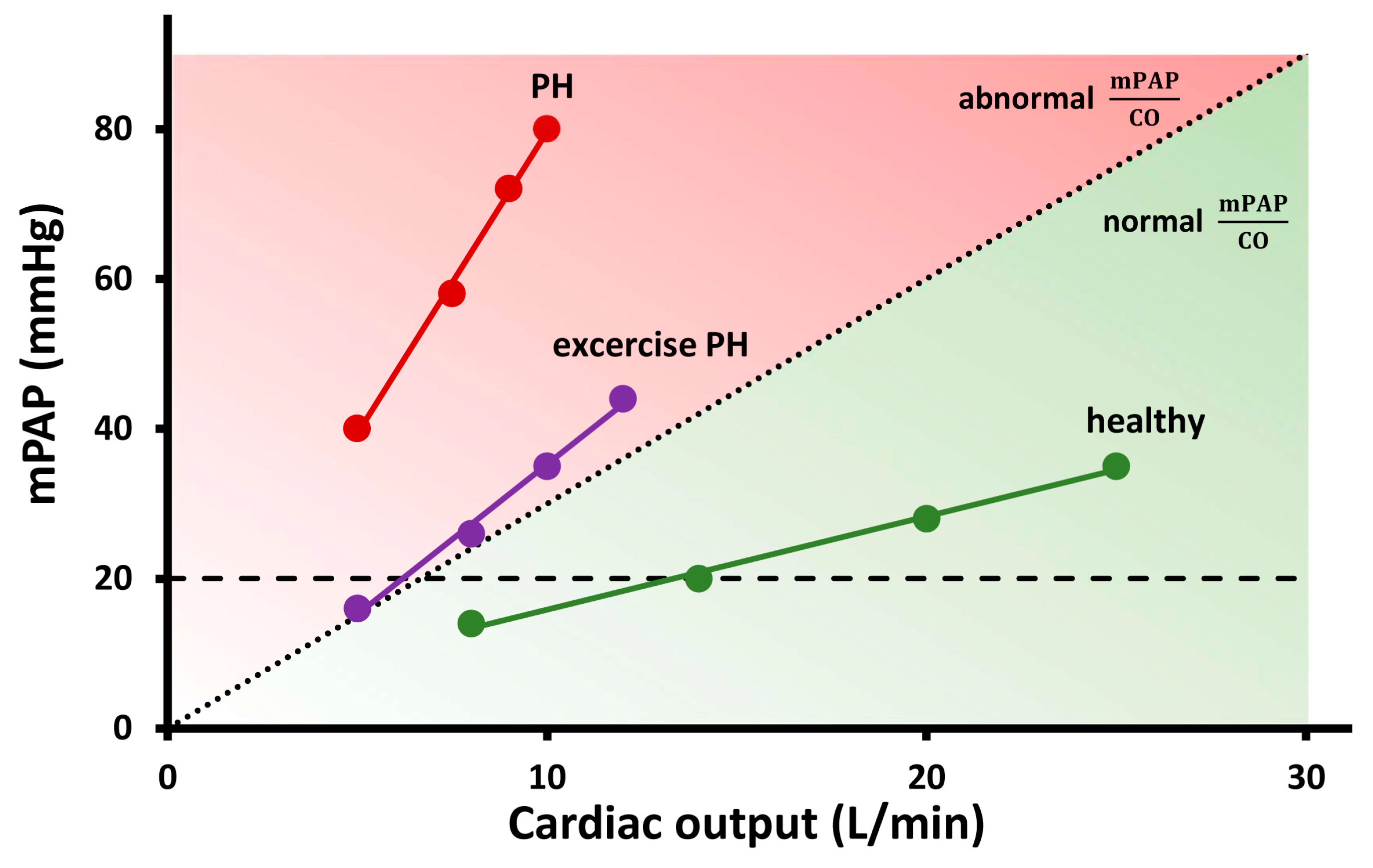 High prevalence of occult left ventricular diastolic dysfunction detected  by exercise stress test in systemic sclerosis