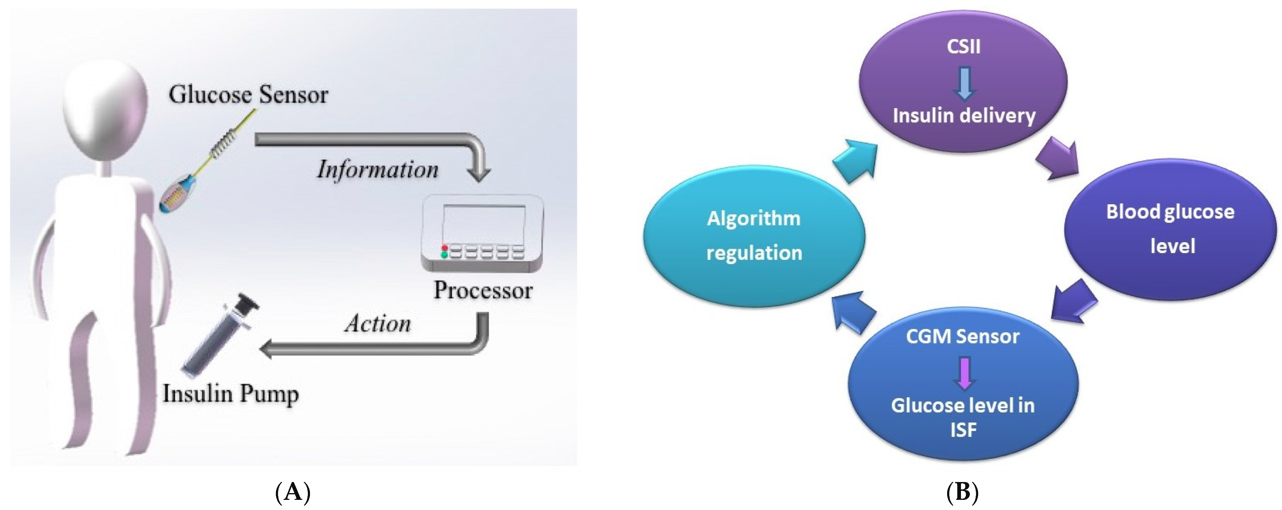 How the iLet ACE Closed-Loop Insulin Pump is So User-Friendly