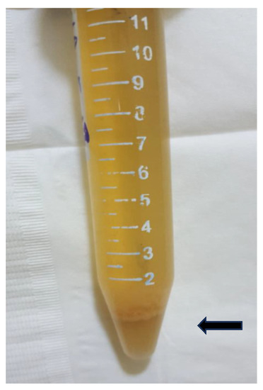 Critical Care Thermometer, 1442