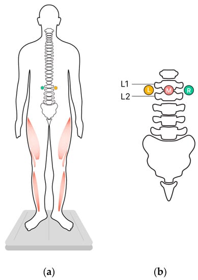 Spinal Cord Stimulation in NYC  Sports Injury & Pain Management