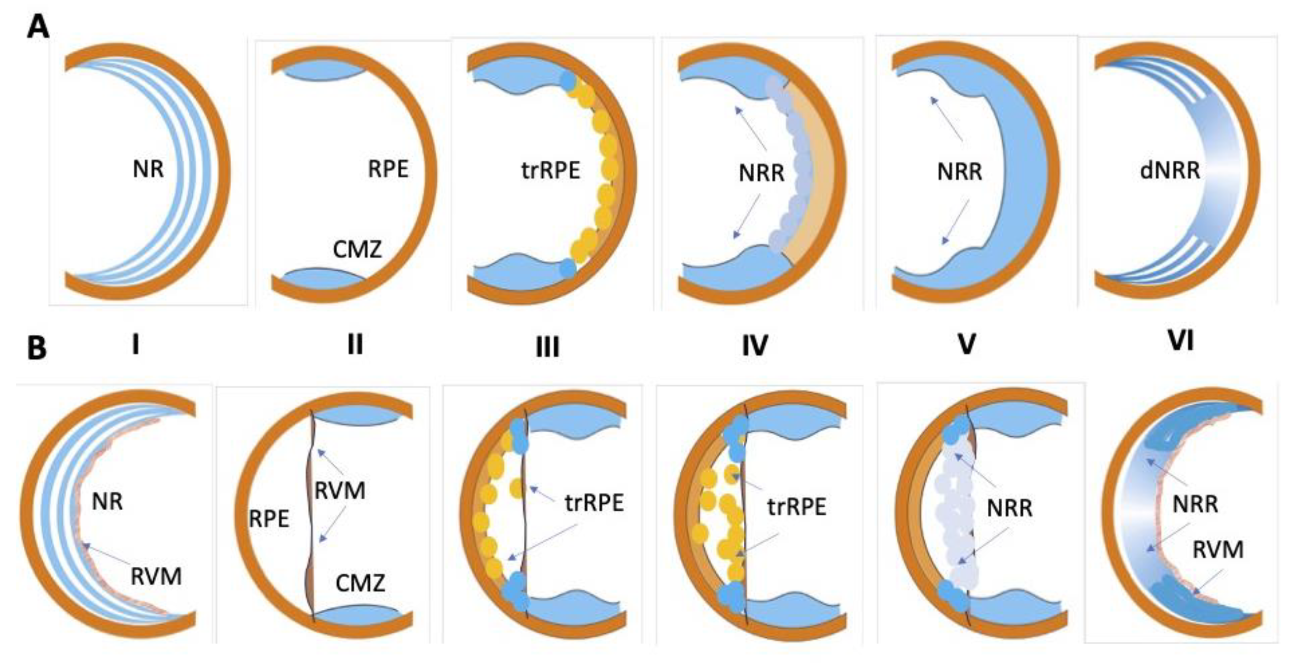 Life | Free Full-Text | Cellular and Molecular Triggers of Retinal