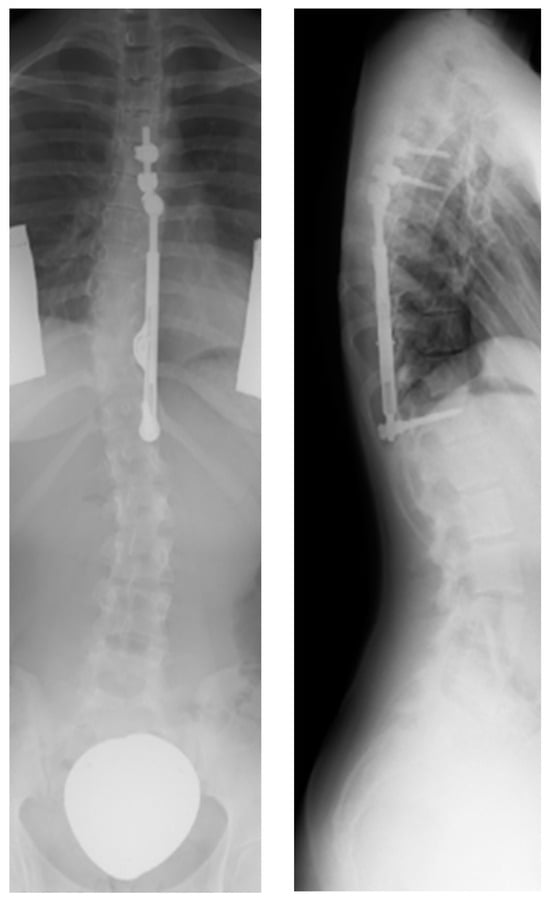 Scoliosis Department - Mobility Medclinic Inc