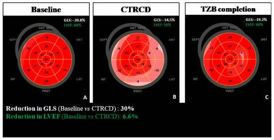 PROGNOSTIC VALUE OF PERSISTENTLY ABNORMAL LEFT VENTRICULAR GLOBAL  LONGITUDINAL STRAIN IN PATIENTS WITH SUBARACHNOID HEMORRHAGE