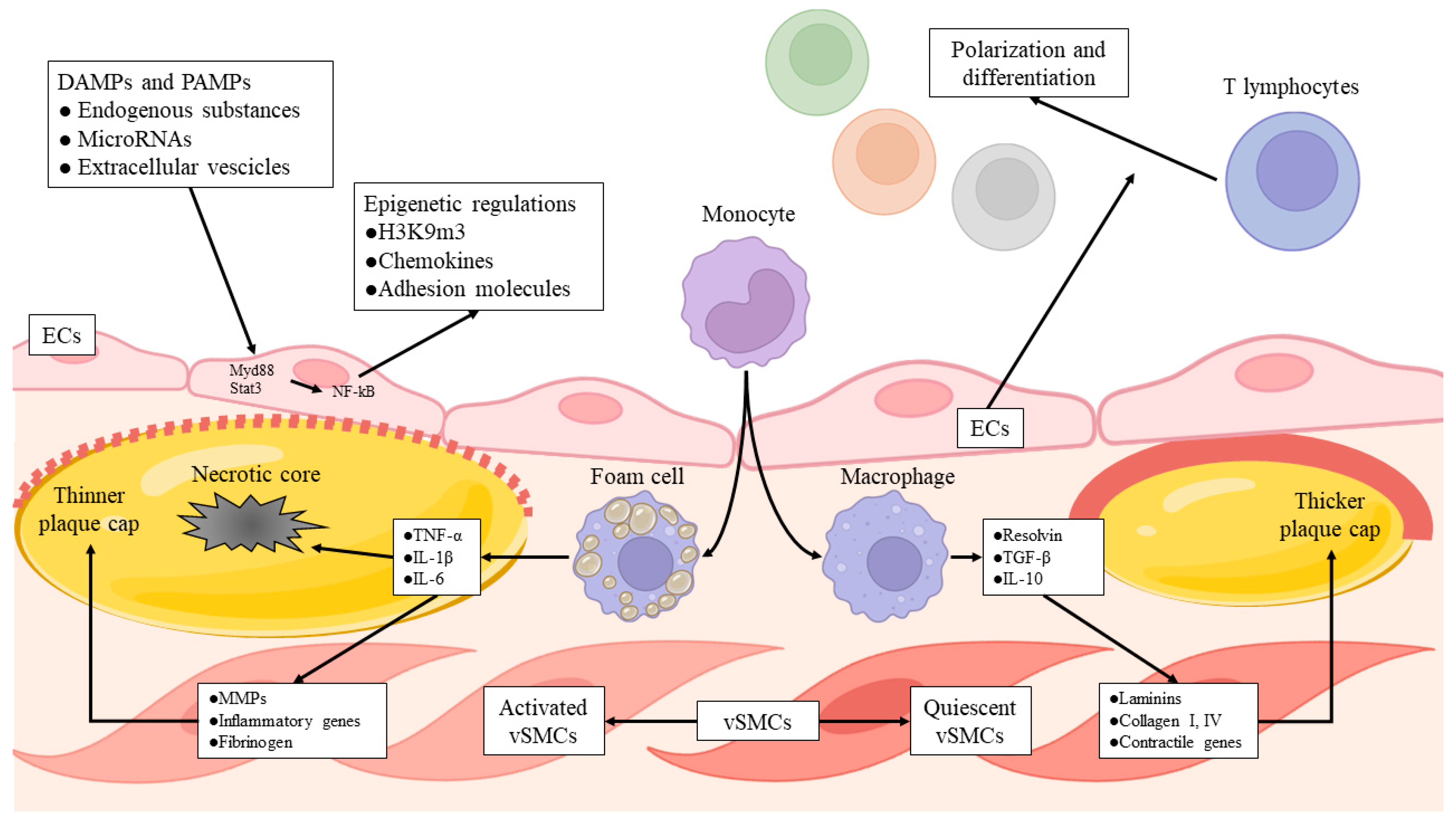 Life | Free Full-Text | Impact of Immunity on Coronary Artery 