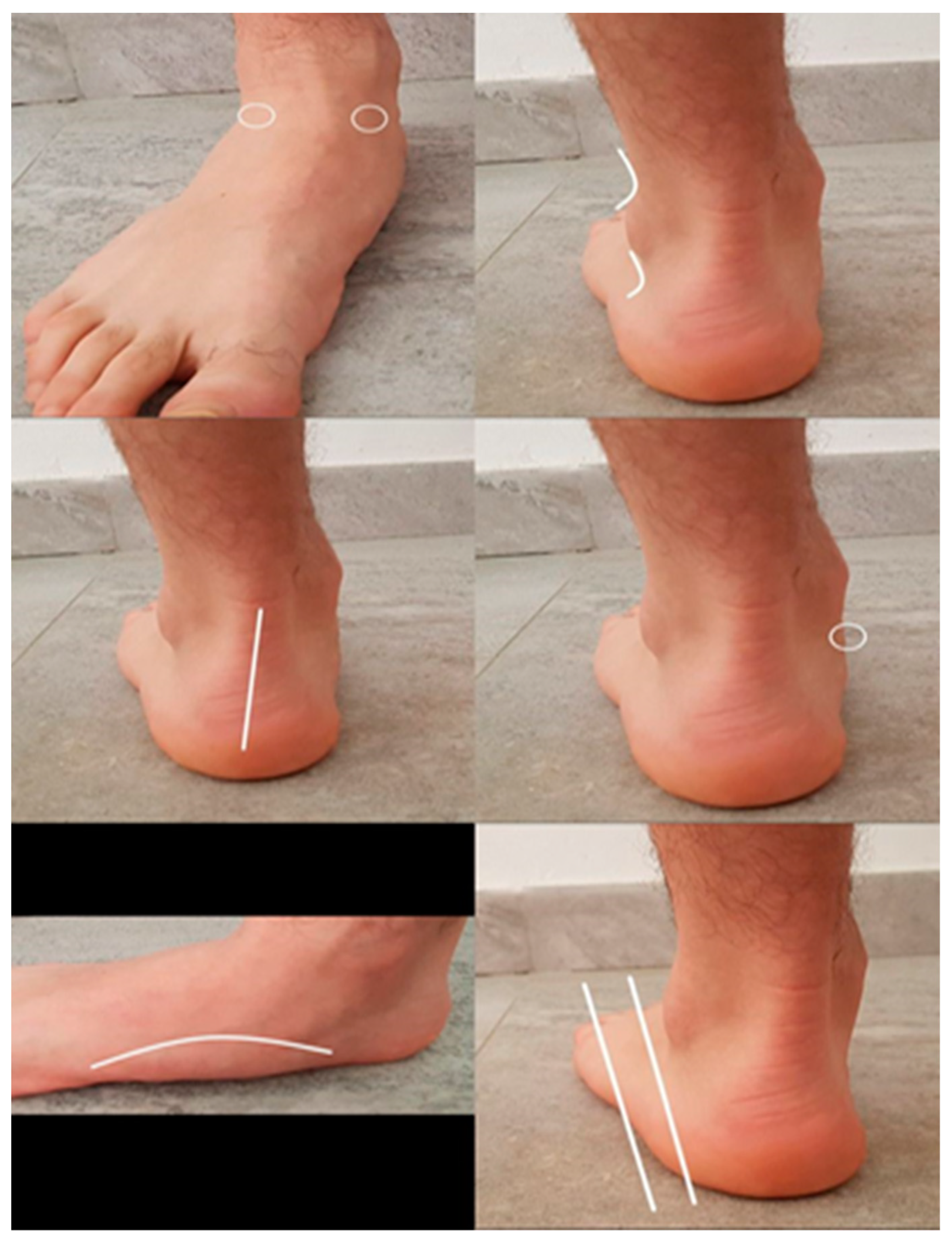 Foot/Ankle