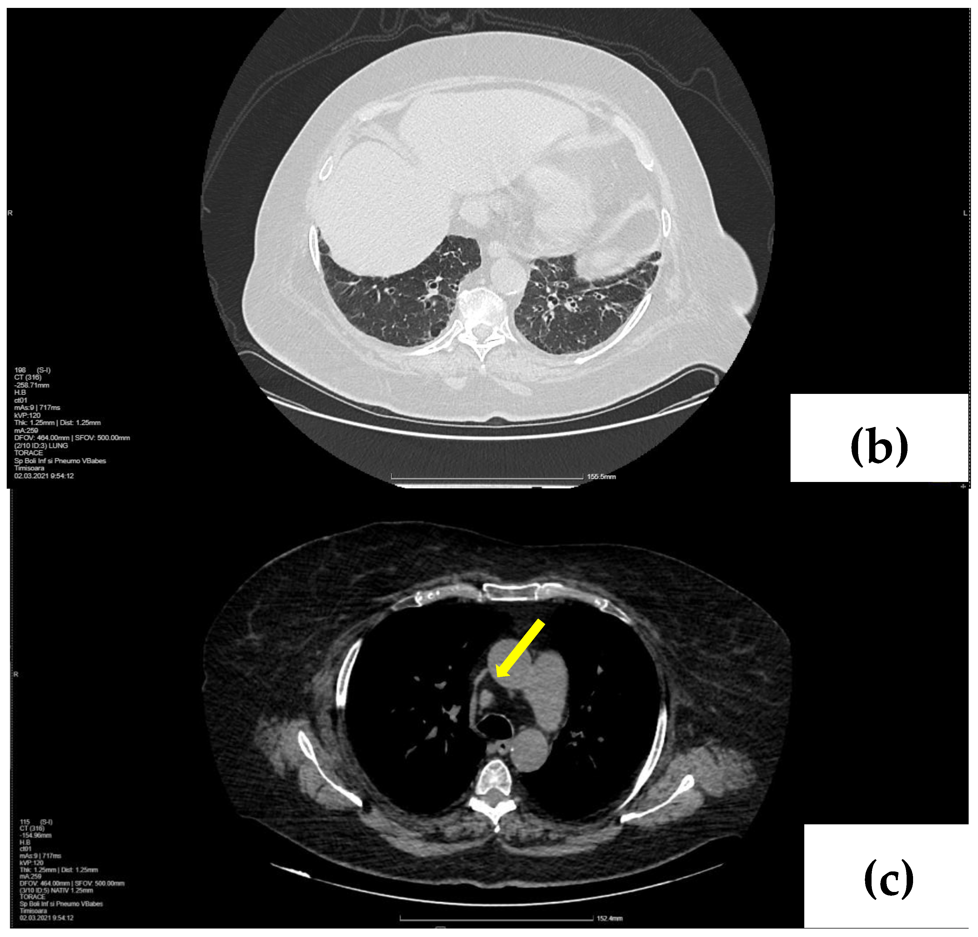 Life 14 00044 g003b Life 14 00044 g003b