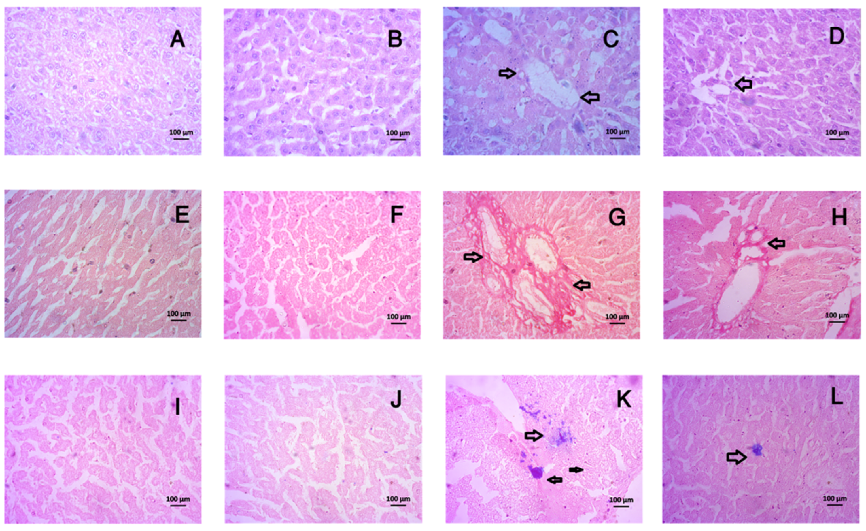 Livers 03 00010 g008 Livers 03 00010 g008