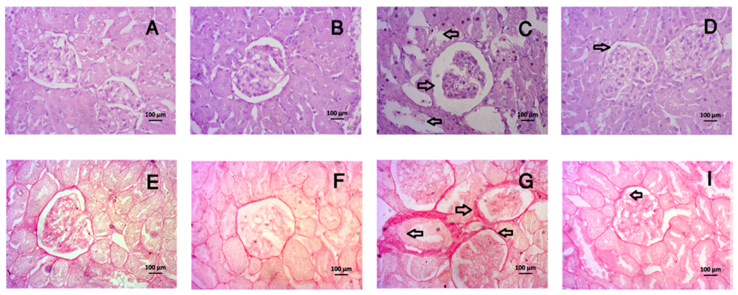 Livers 03 00010 g009 Livers 03 00010 g009