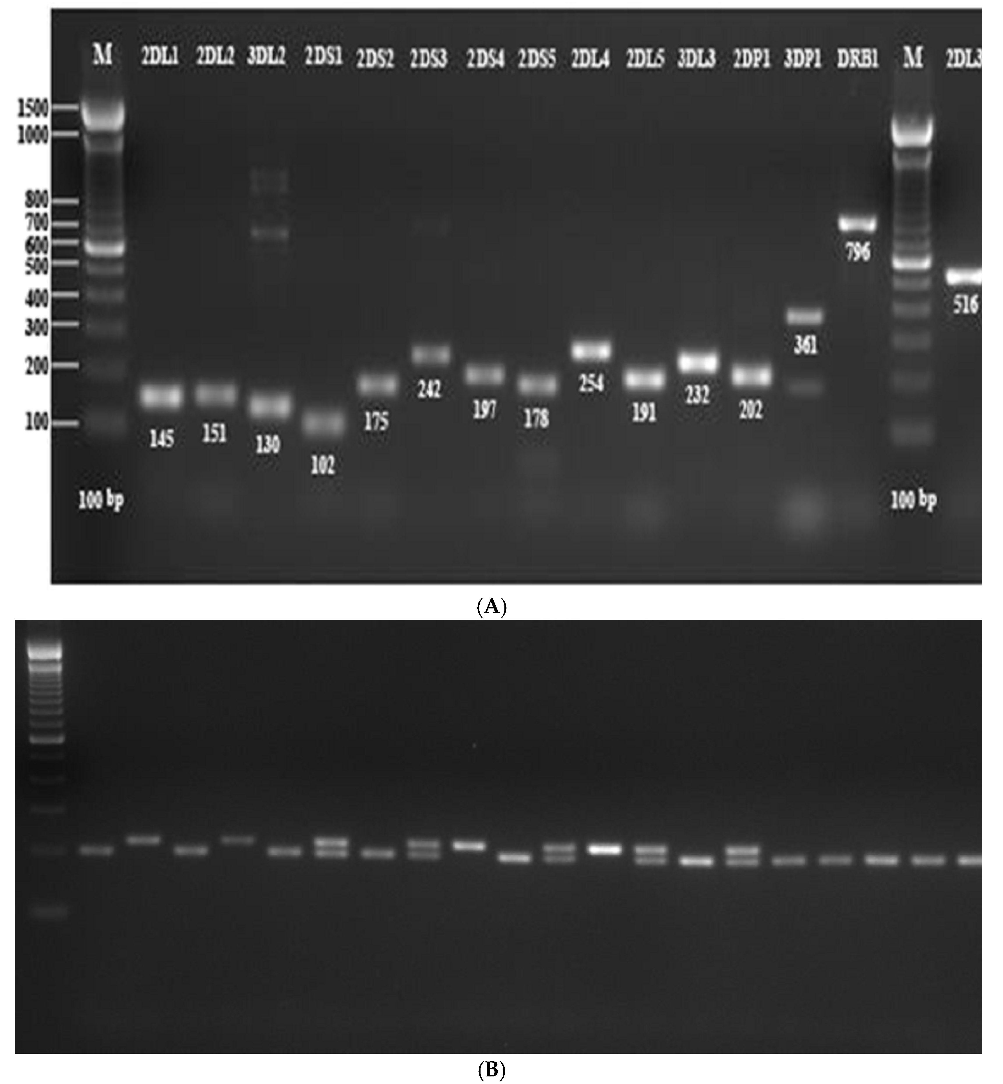 The genotype differences of TNF genotyping between workers and