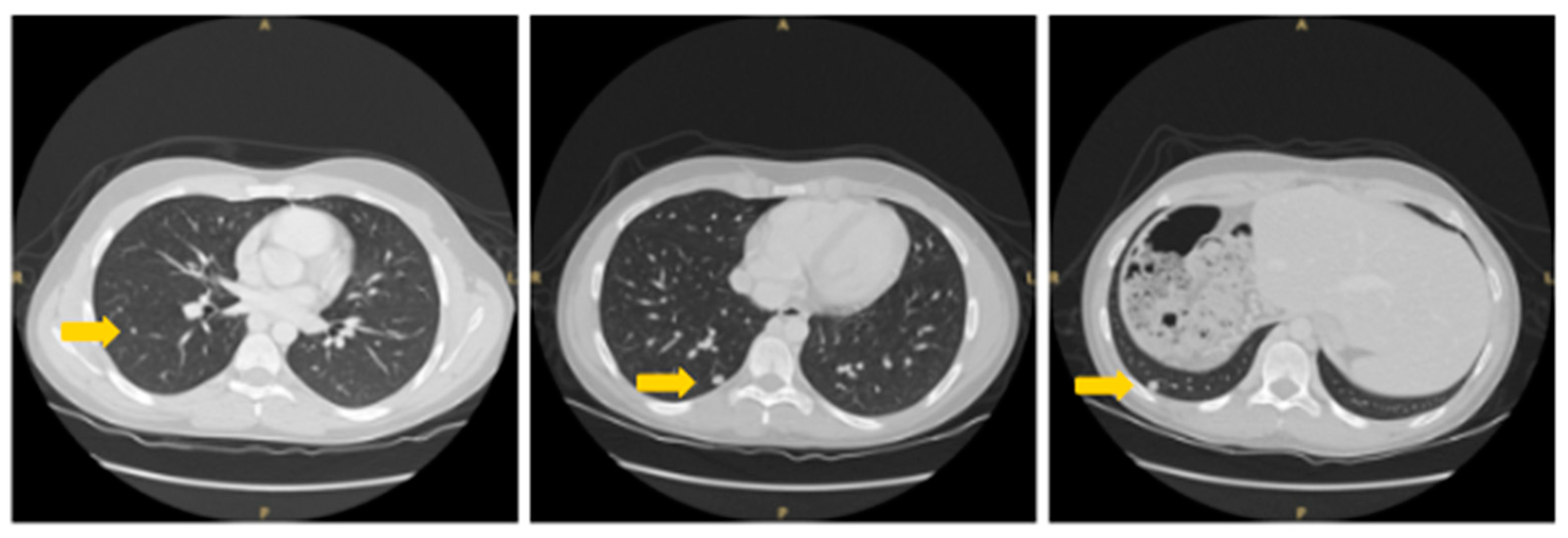 Livers 04 00029 g001