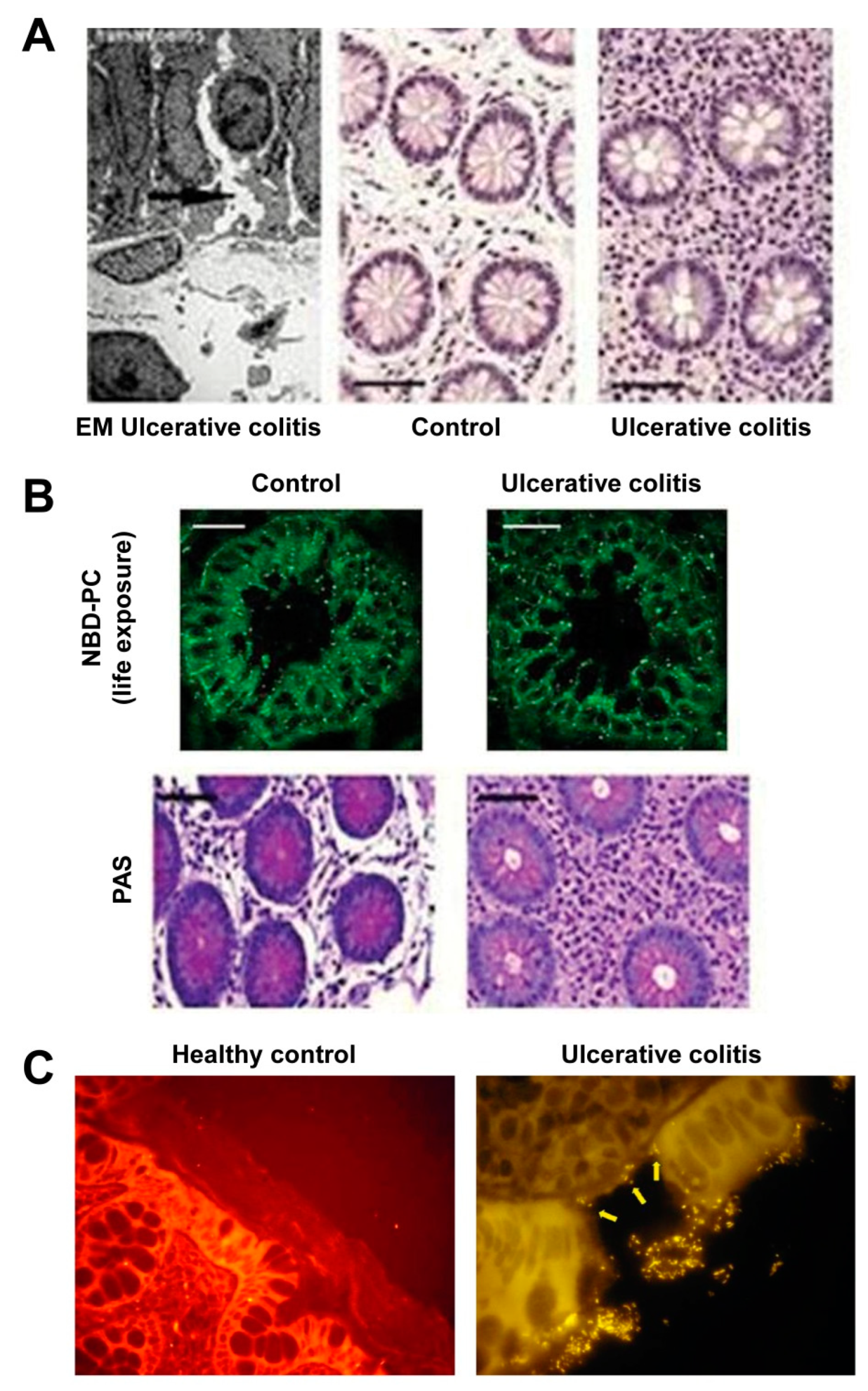Livers 04 00034 g005 Livers 04 00034 g005