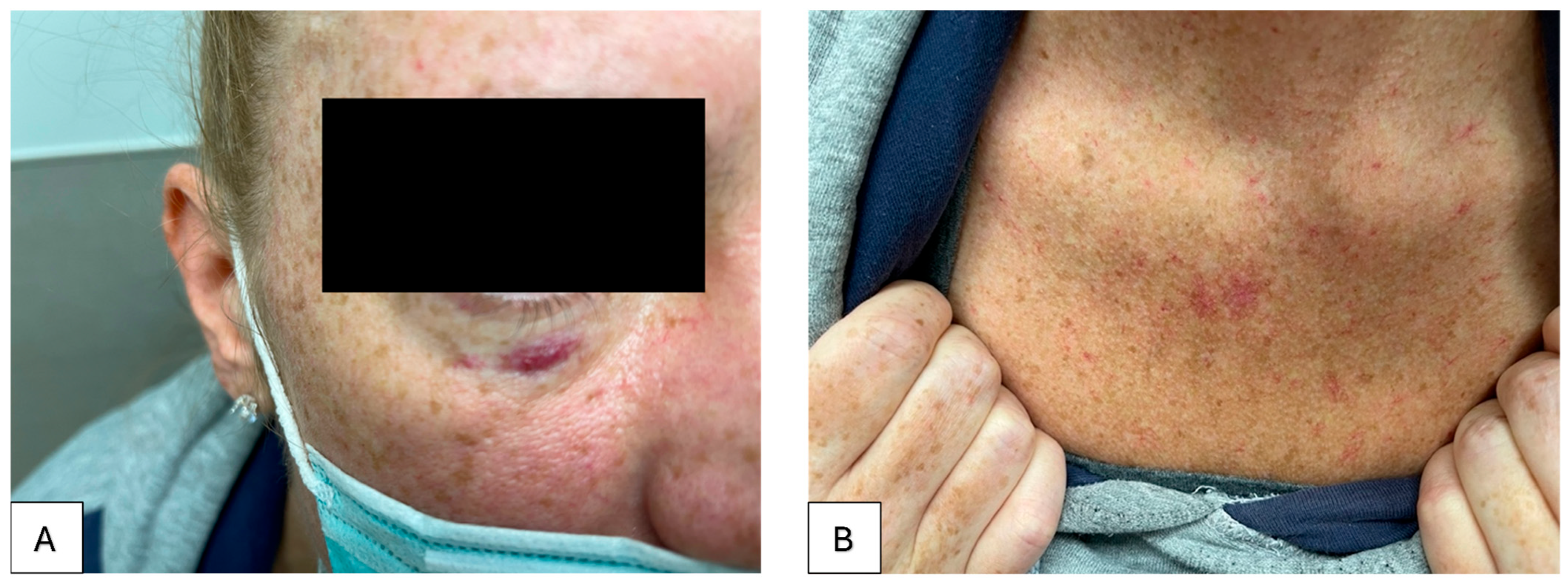 Livers 05 00037 g001 Livers 05 00037 g001