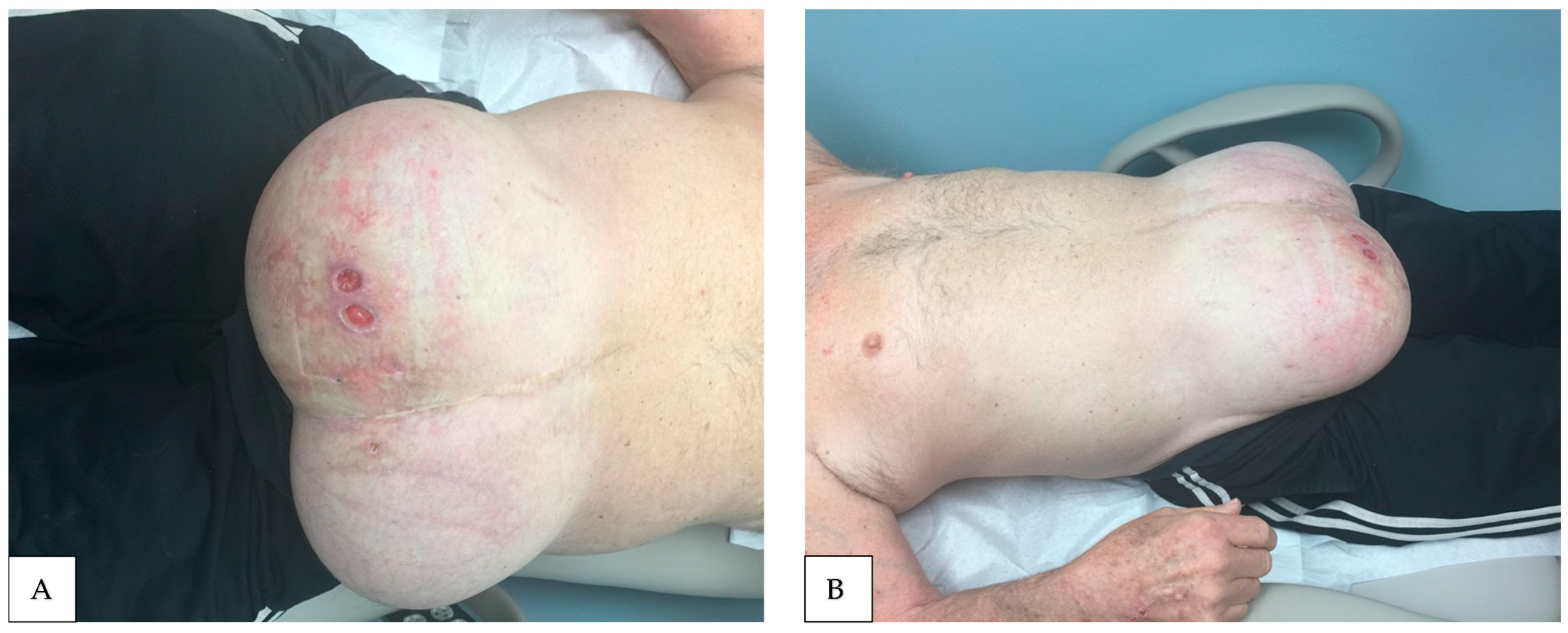 Livers 05 00037 g006 Livers 05 00037 g006