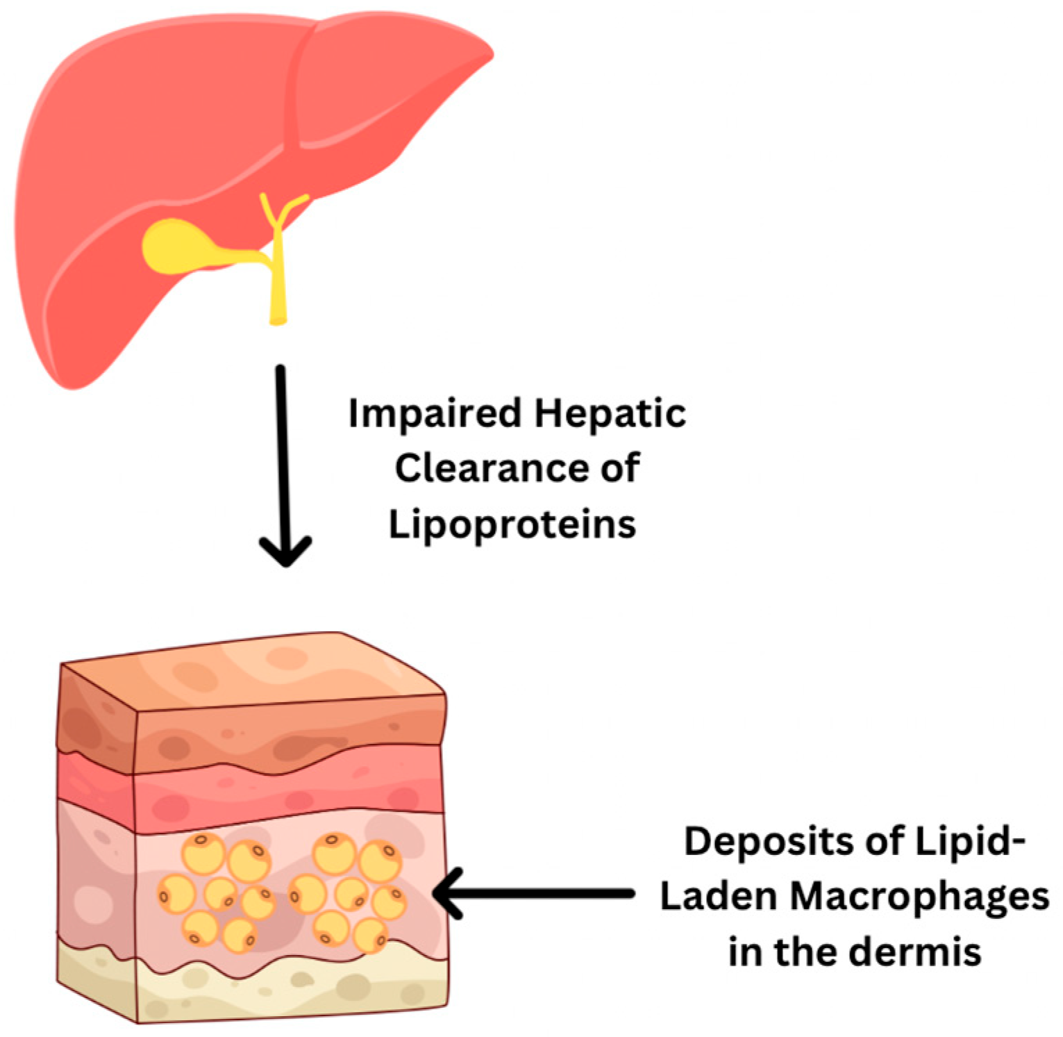 Livers 05 00037 g008 Livers 05 00037 g008