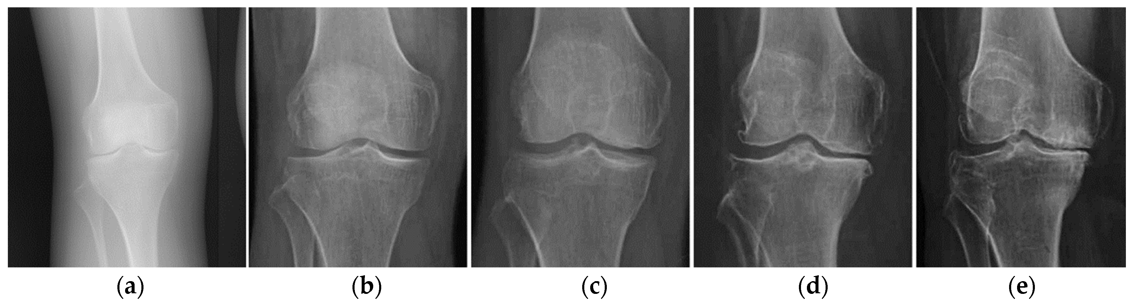 Lubricants | Free Full-Text | Synovial Joints. Tribology, Regeneration ...